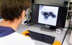 Un científico observa la imagen microscópica del virus de la viruela del mono a través de un ordenador