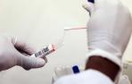 Médicos de atención primaria denuncian su falta de recursos y de test rápidos