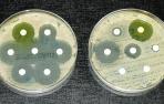 Bacterias resistentes a los antibióticos: un problema serio