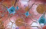 alzheimer-proteinas