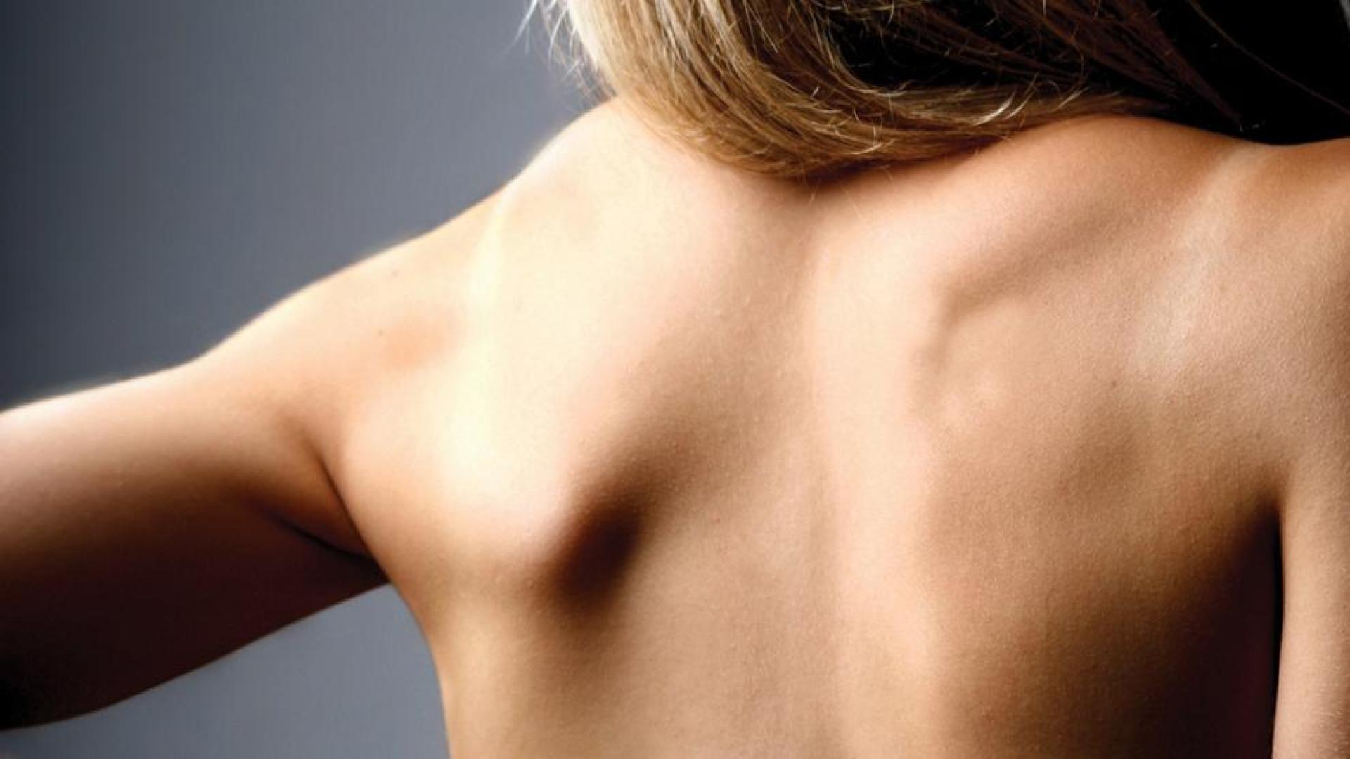 Consejos para prevenir el dolor de espalda