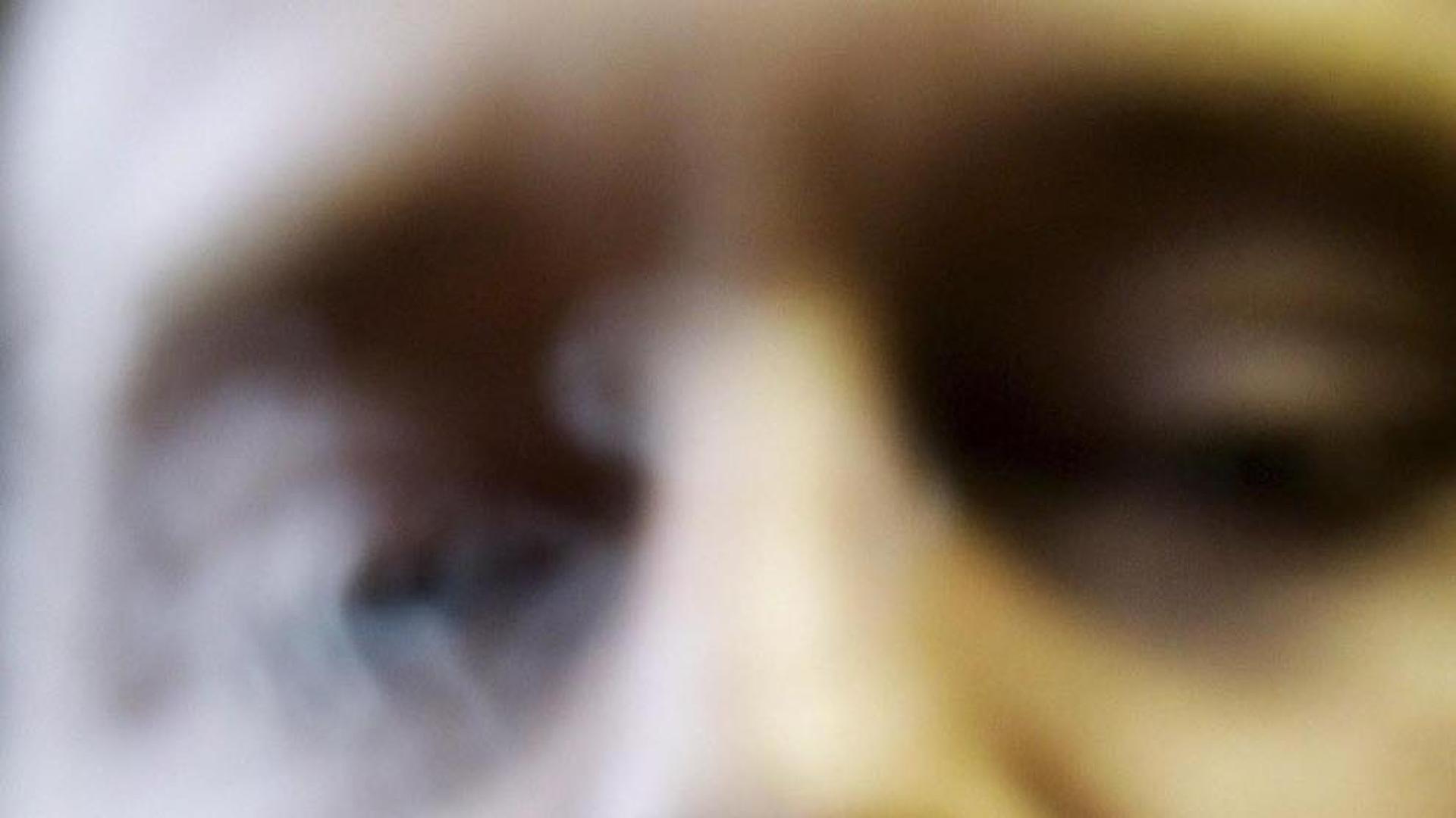 El cigarro electrónico puede afectar a los pulmones