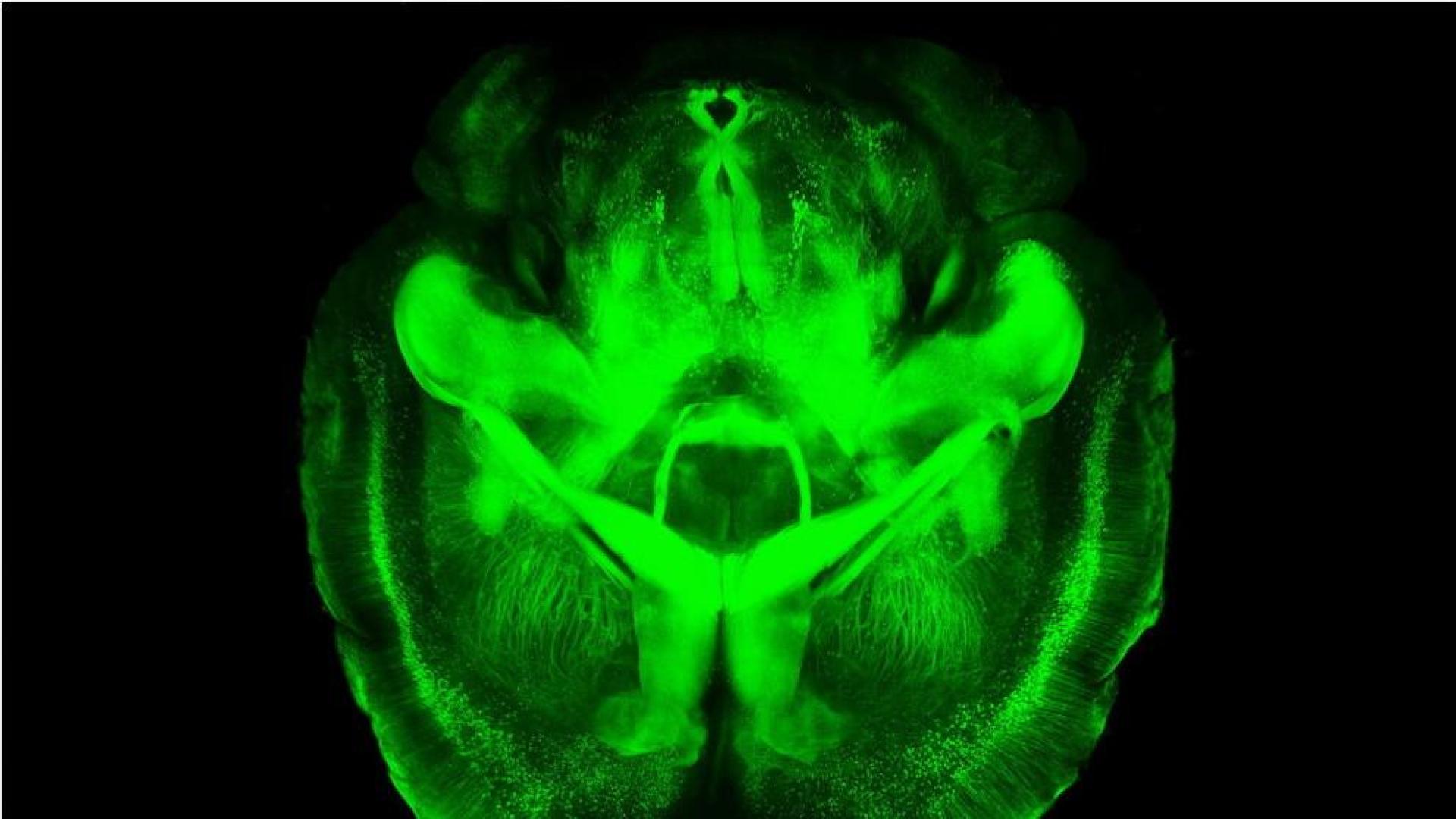 El cerebro se vuelve transparente para la ciencia