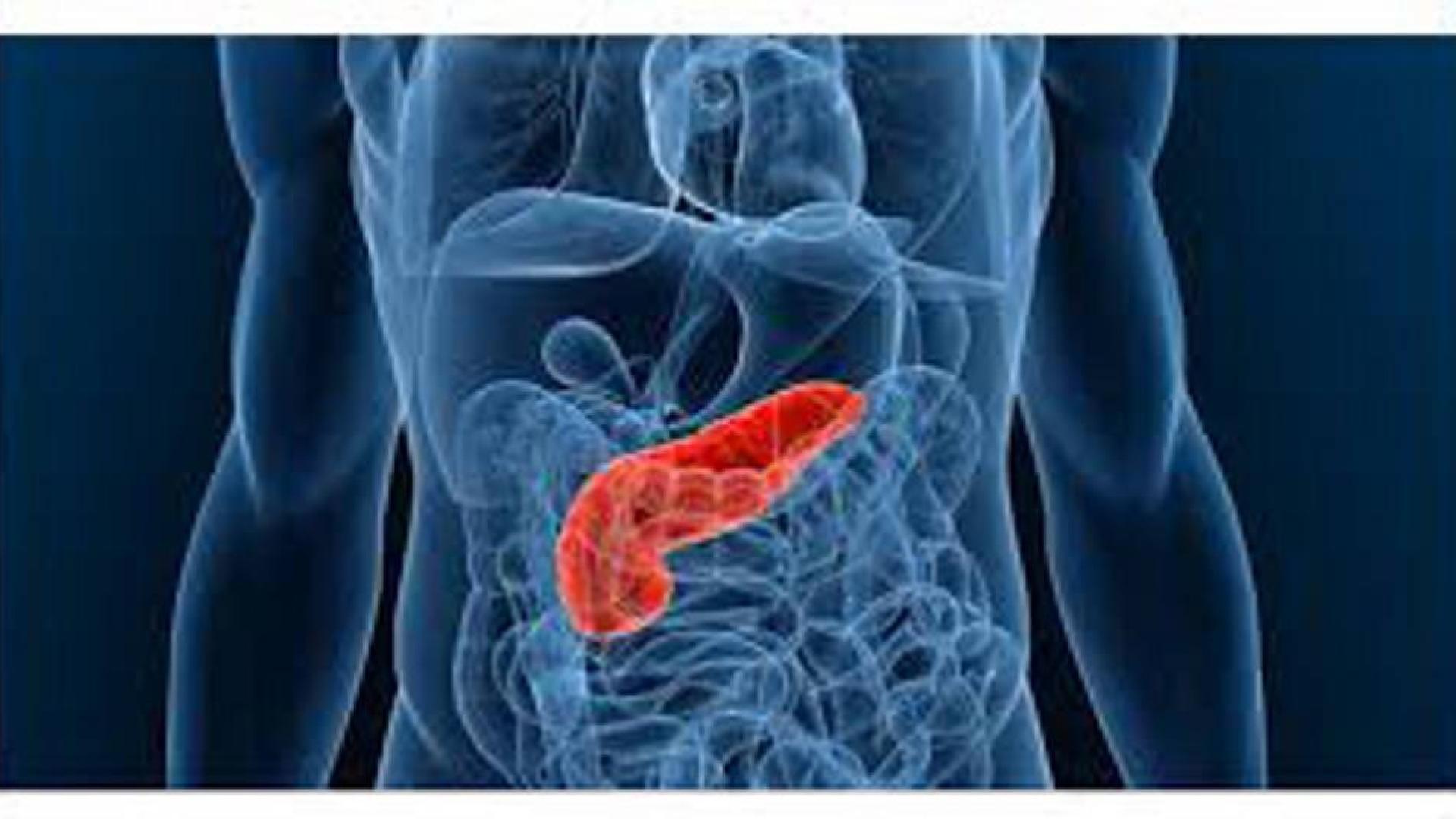 La reducción de antioxidantes, ¿clave para la cura del cáncer de páncreas?