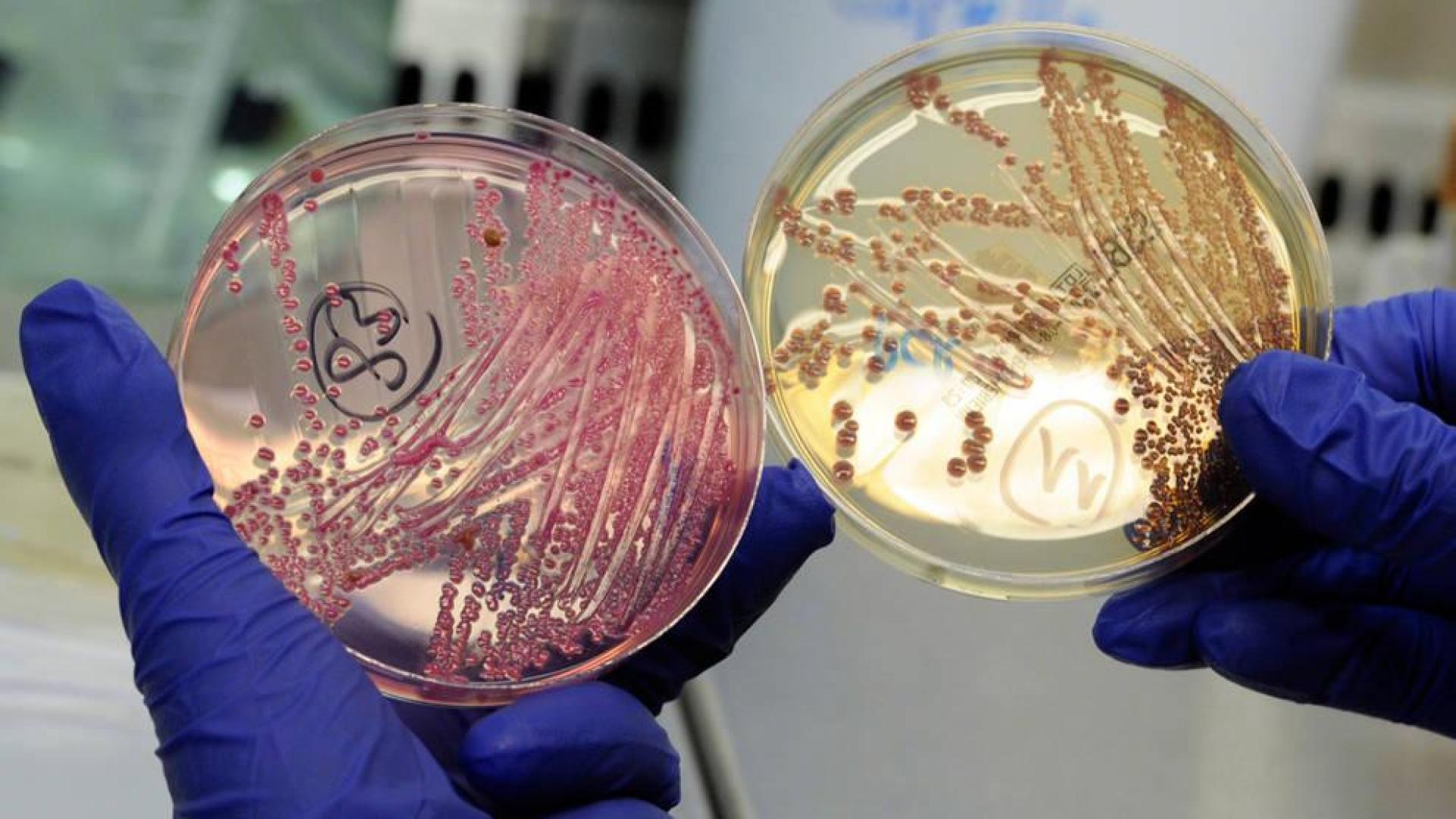 Científicos de Harvard muestran la resistencia de bacterias a antibióticos