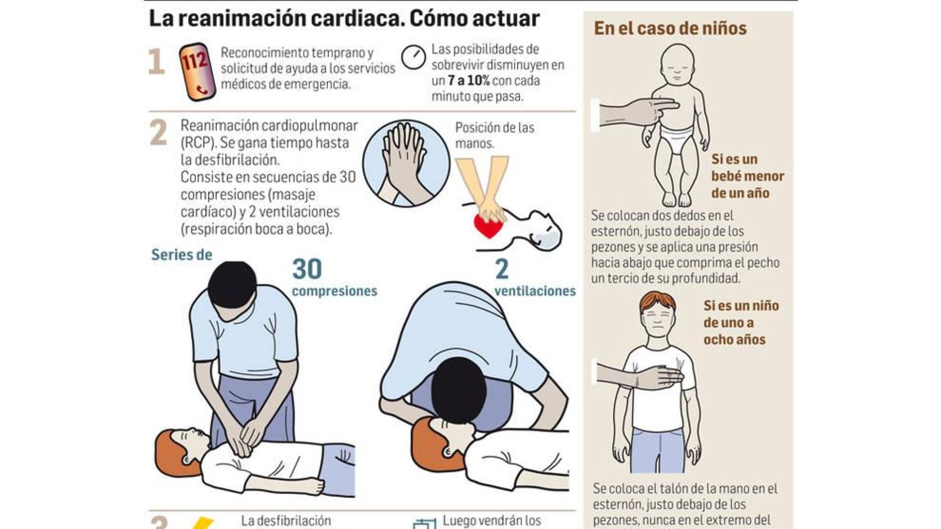 Procedimiento gráfico de actuación con el desfibrilador