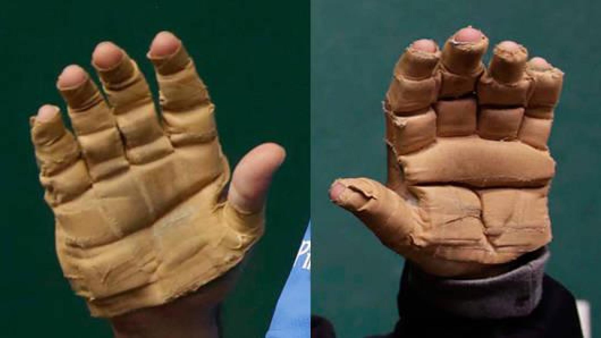 Las manos de Urrutikoetxea (izda.) y Bengoetxea (dcha.)