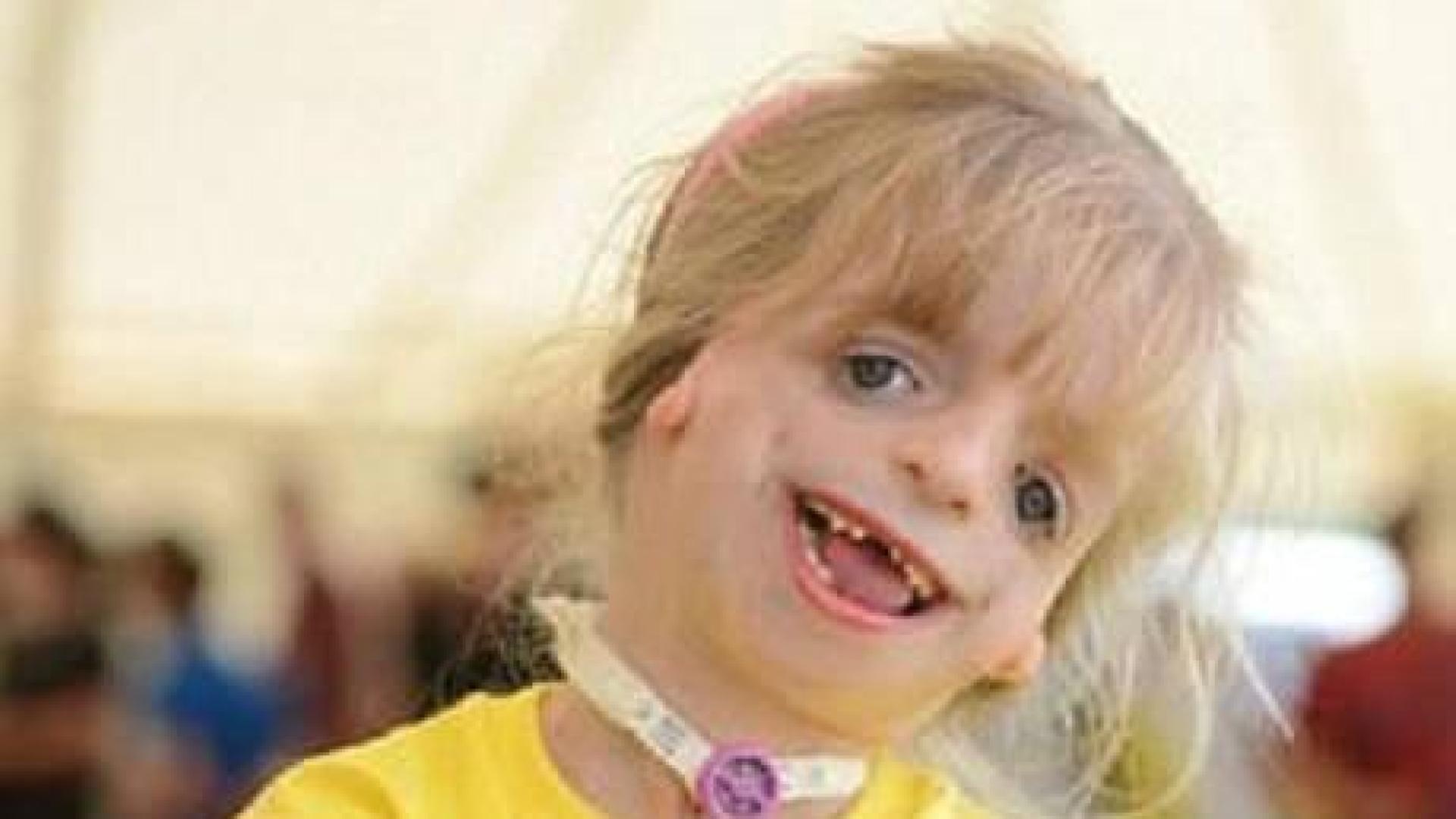 La historia de superación de Maisie Coulton, la niña que ha sido operada más de 20 veces