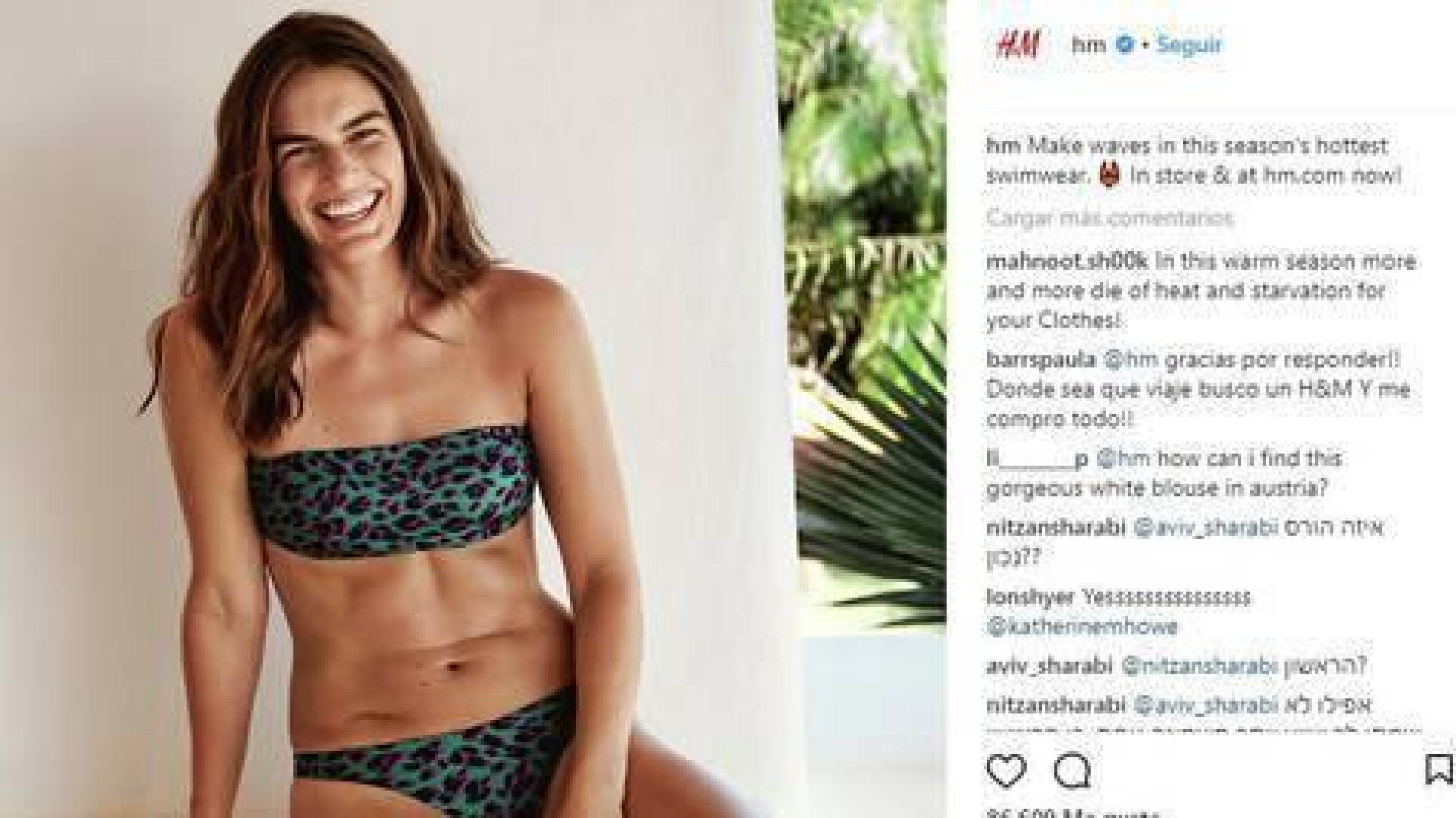 Celulitis, estrías y cicatrices en la campaña de verano de H&M
