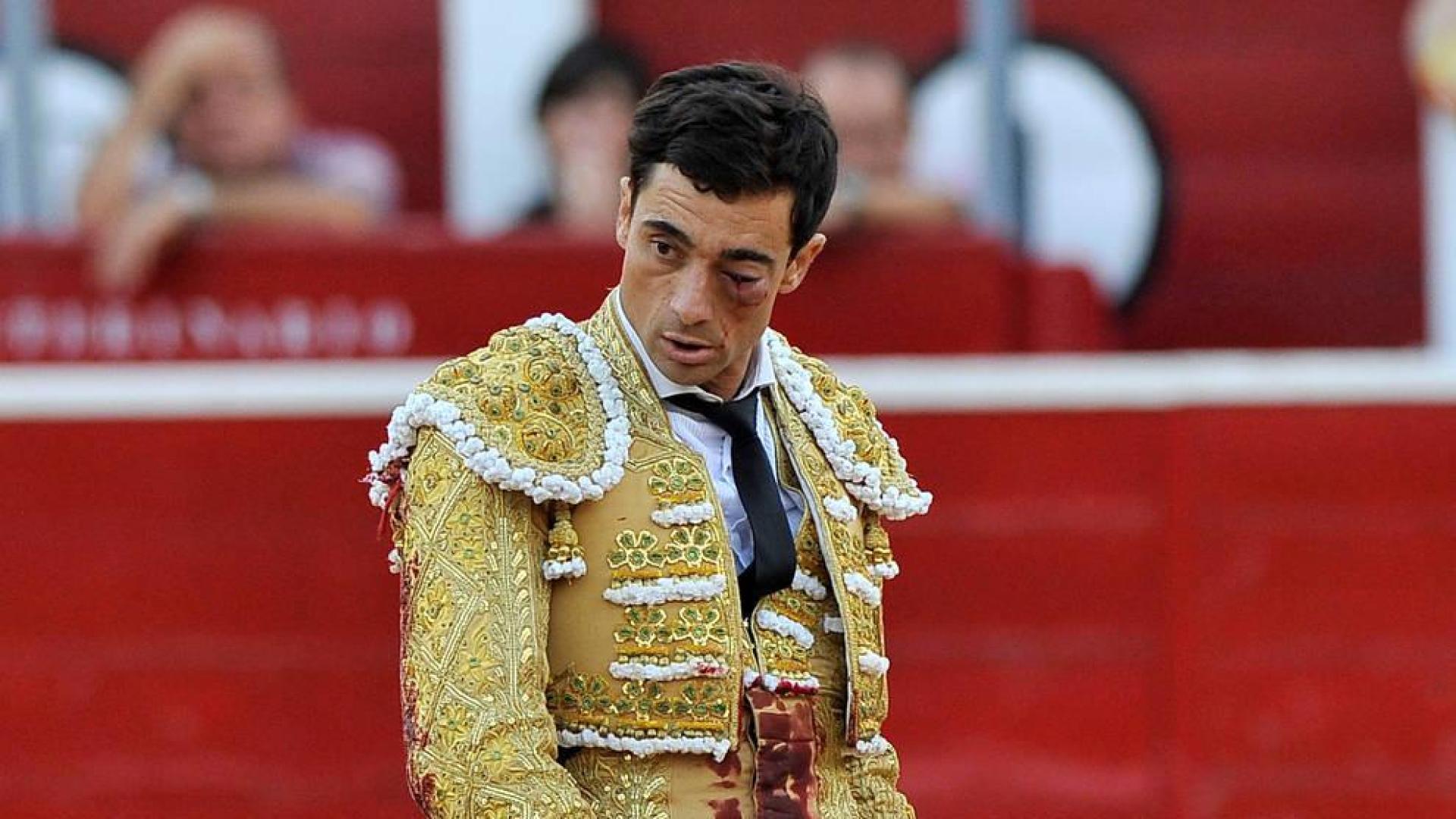 Ureña salva el ojo aunque va a ser "muy complicado" que recupere la visión