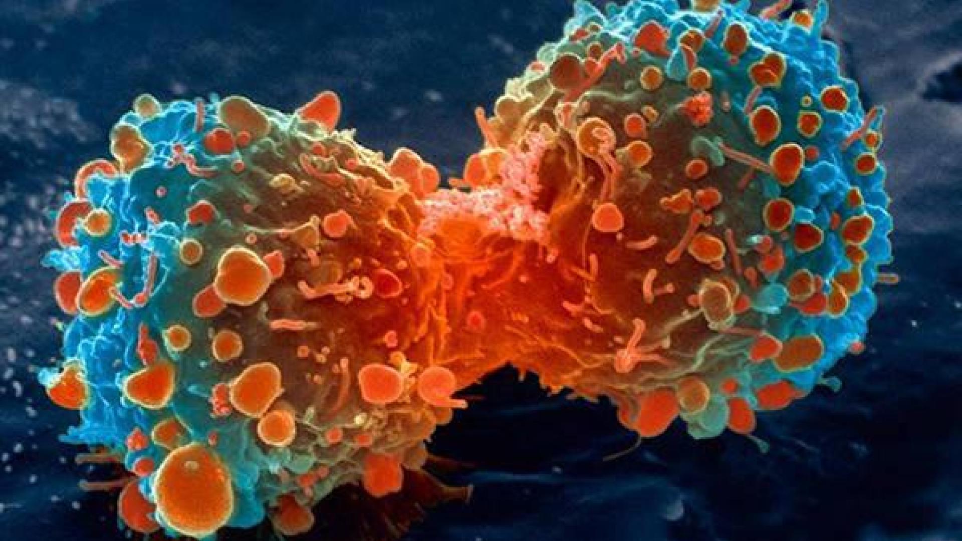 Una célula de cáncer de pulmón dividida.