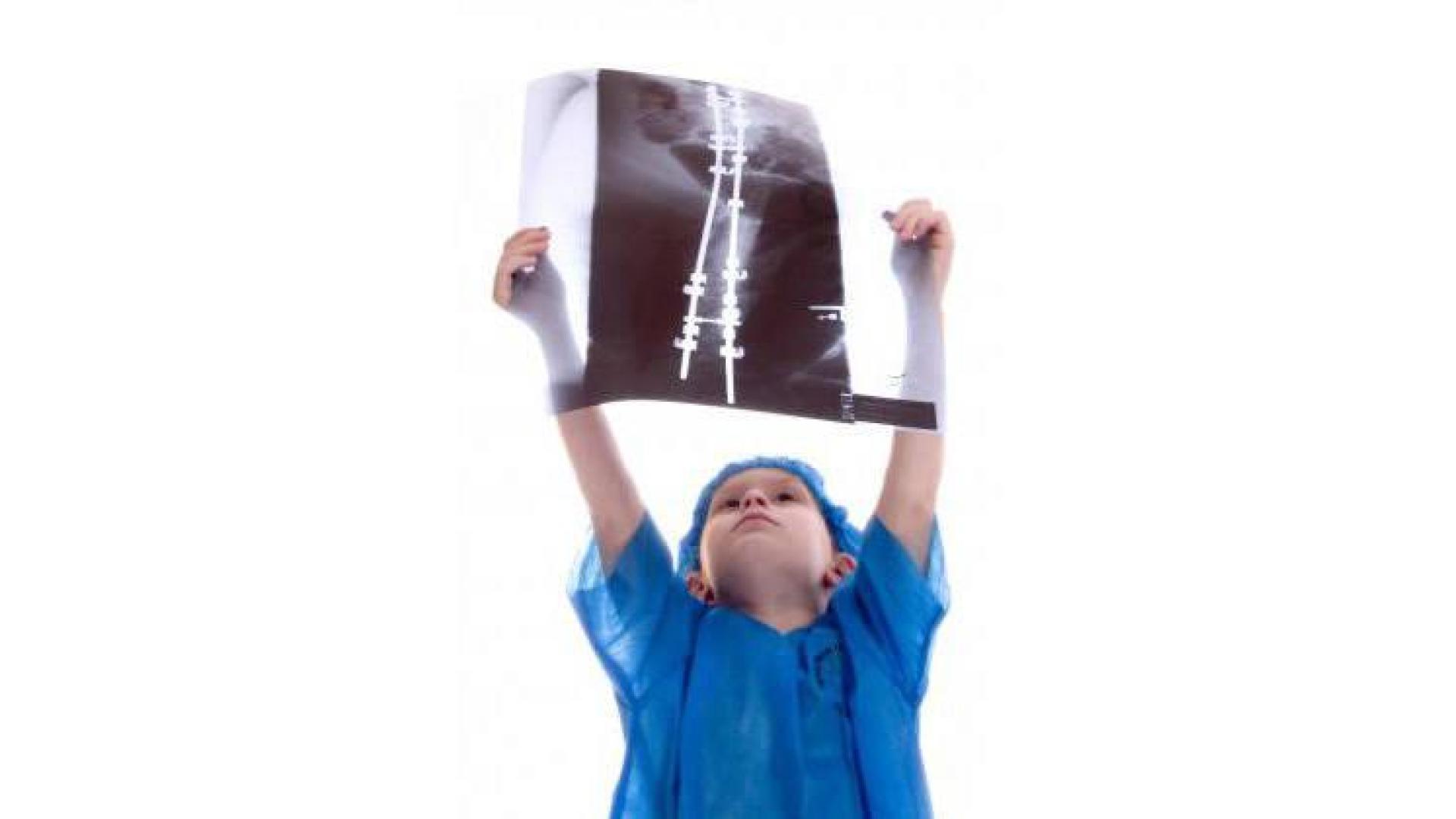 Imagen recurso de una radiografía de un niño.