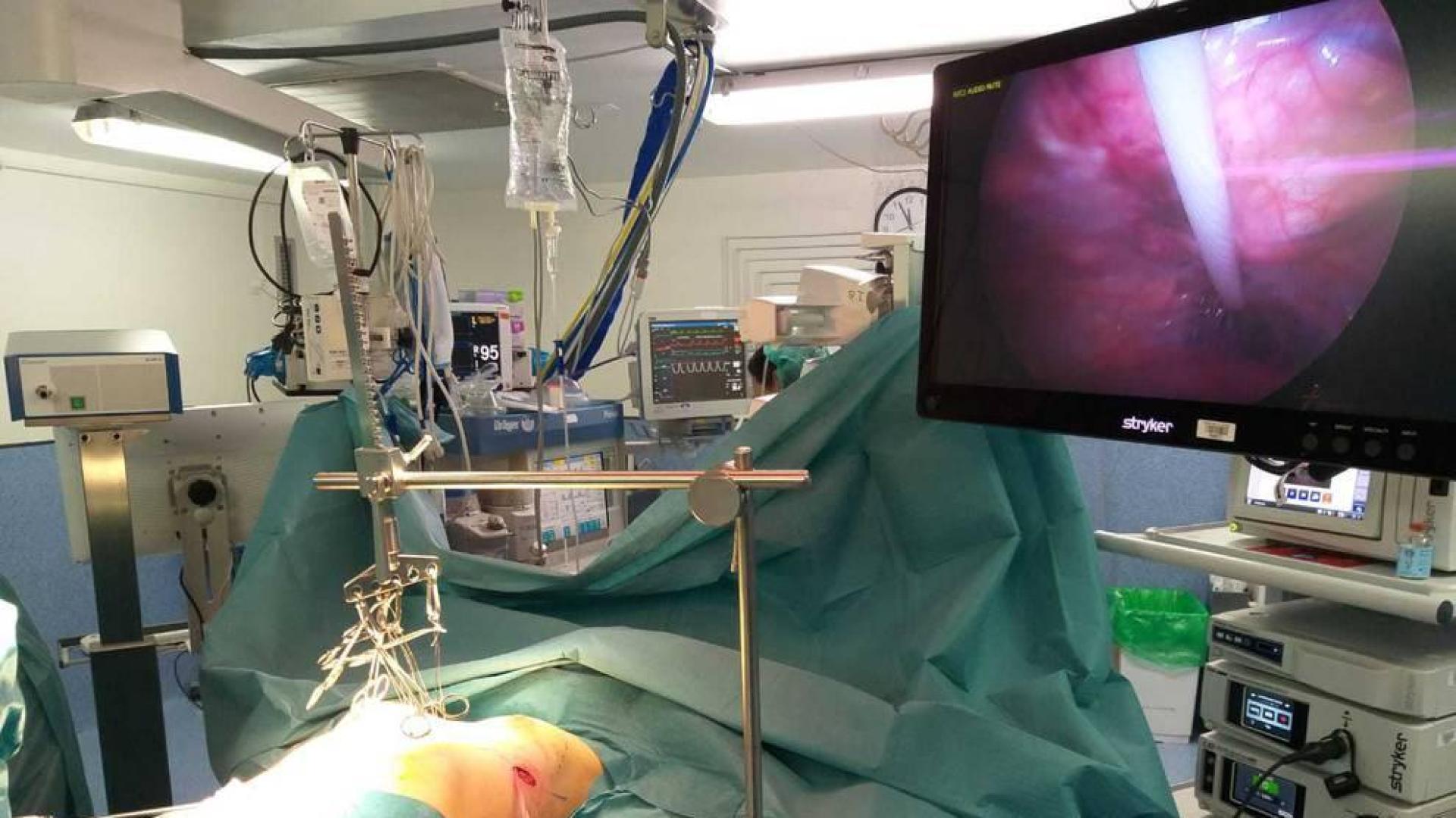 Una intervención de “pectus excavatum” o “pecho hundido”.