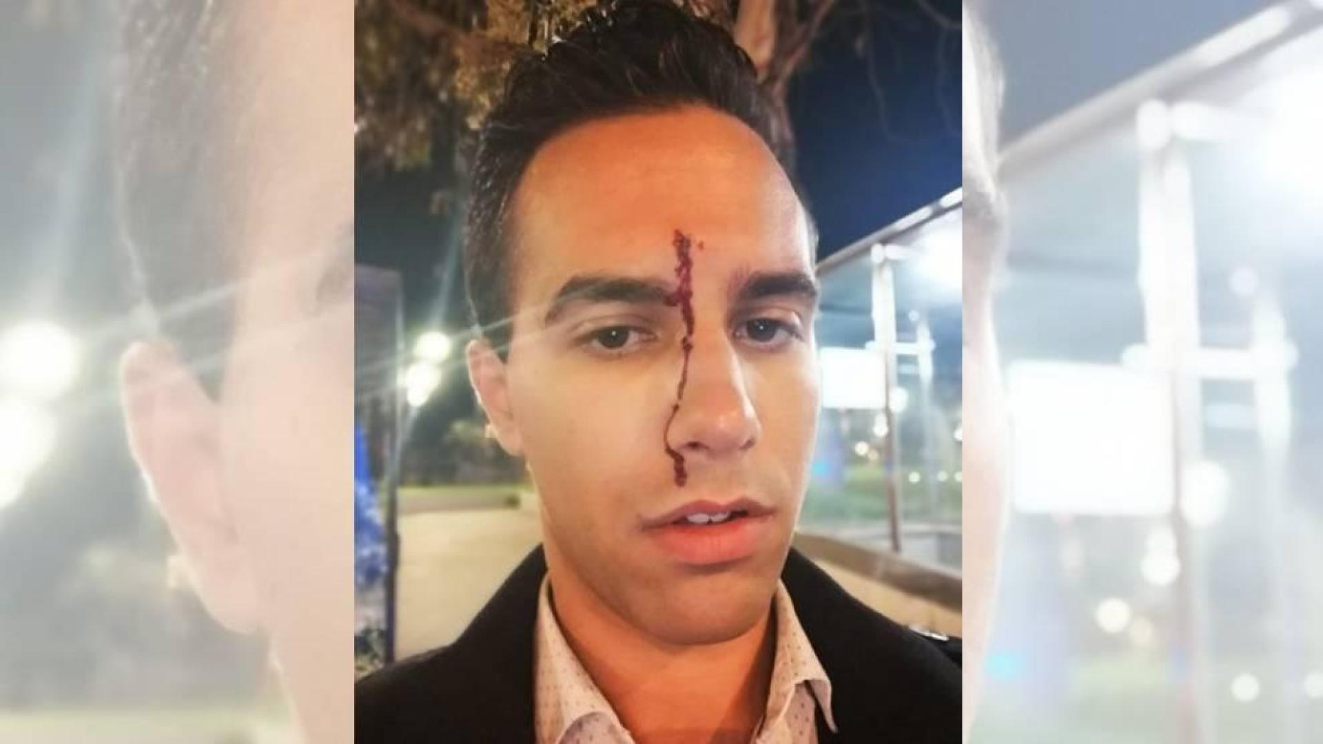 Un periodista y su novio denuncian una agresión homófoba en Barcelona