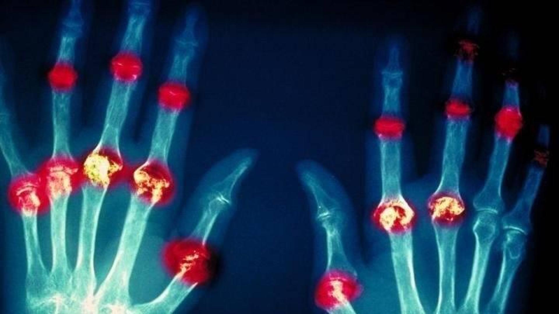 Un grupo de investigadores desarrolla un hidrogel que ayuda a regenerar el cartílago
