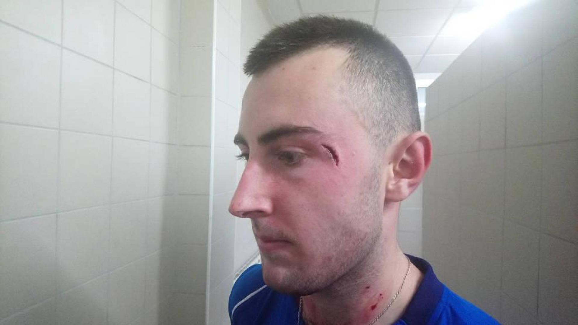 Susto y costurón para Bakaikoa en el telonero