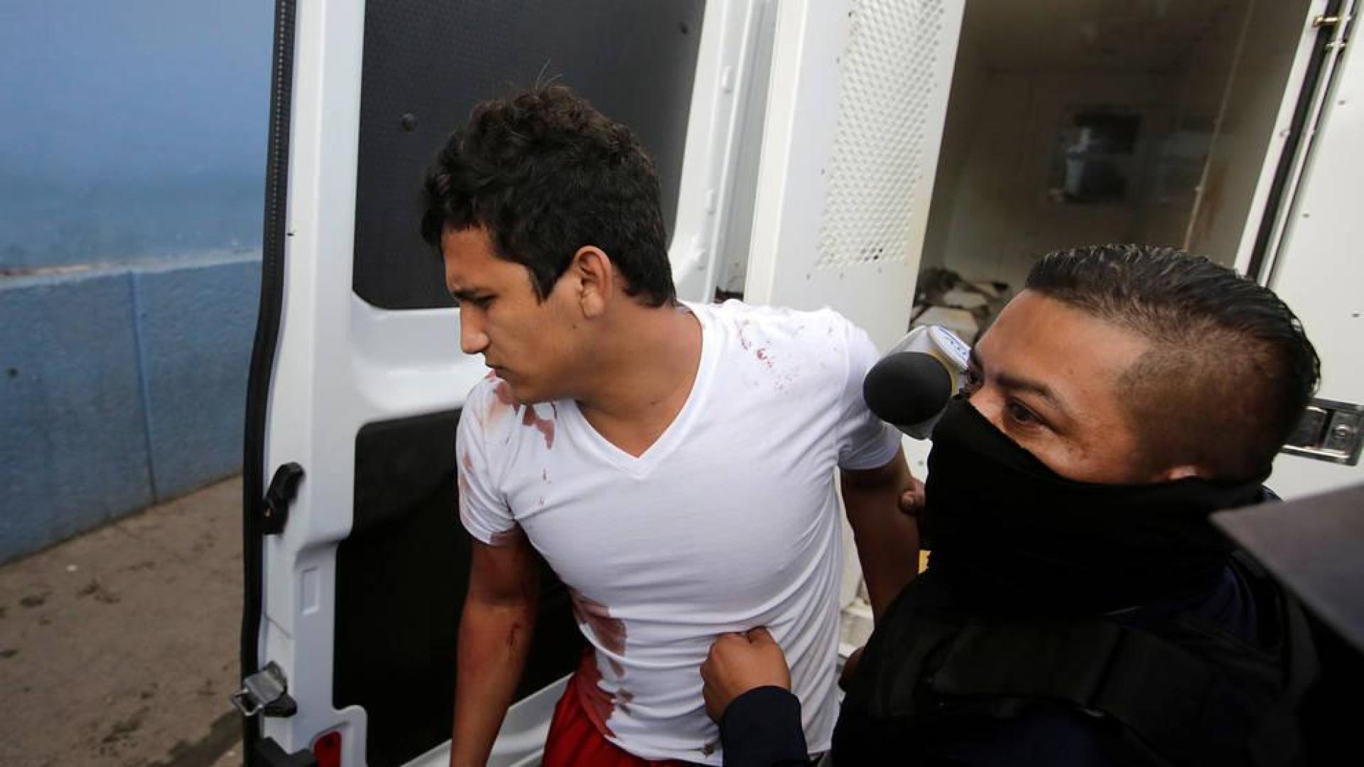 Uno de los presos heridos llega al hospital.