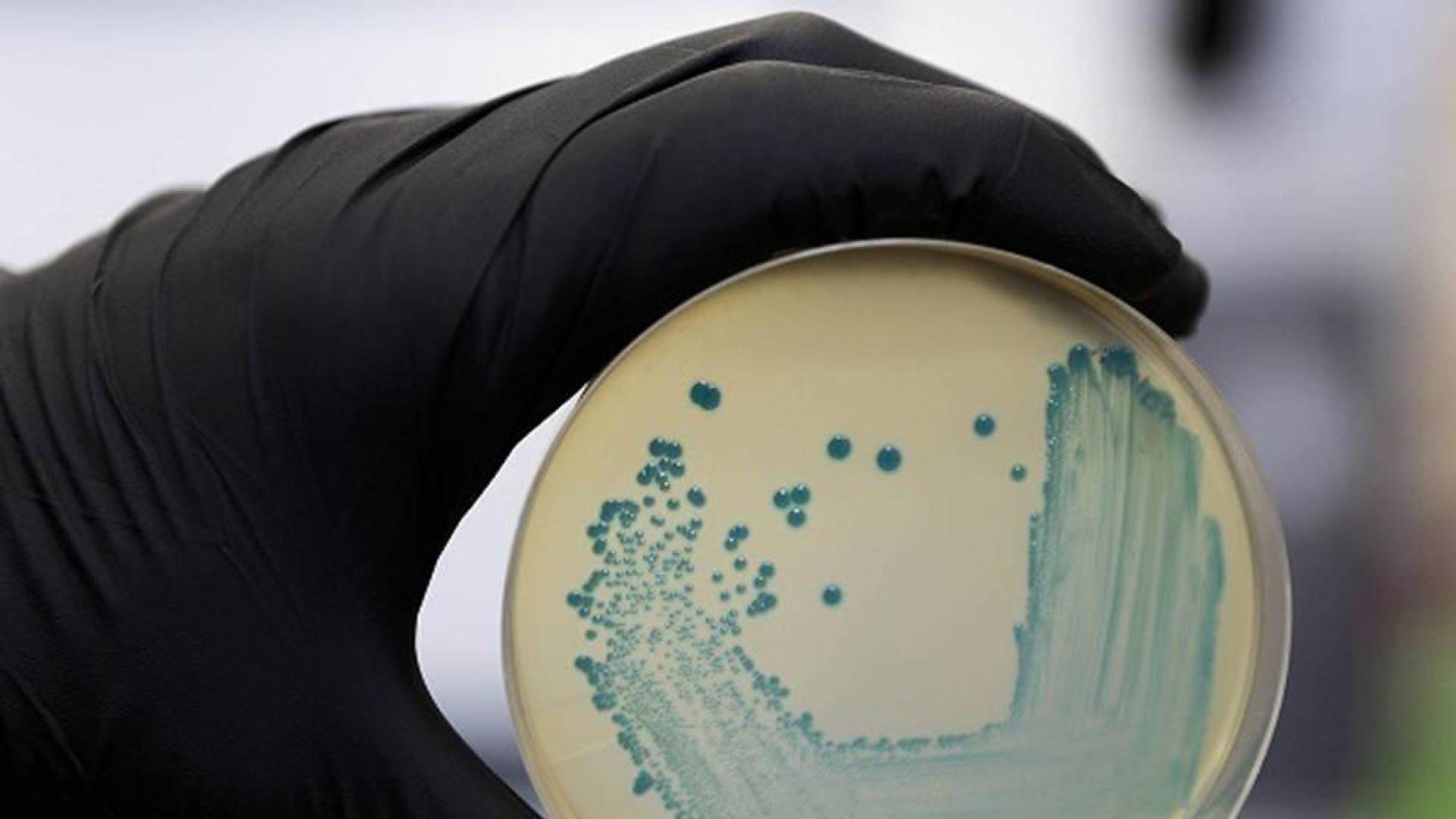 Imagen de un cultivo de la bacteria listeria.