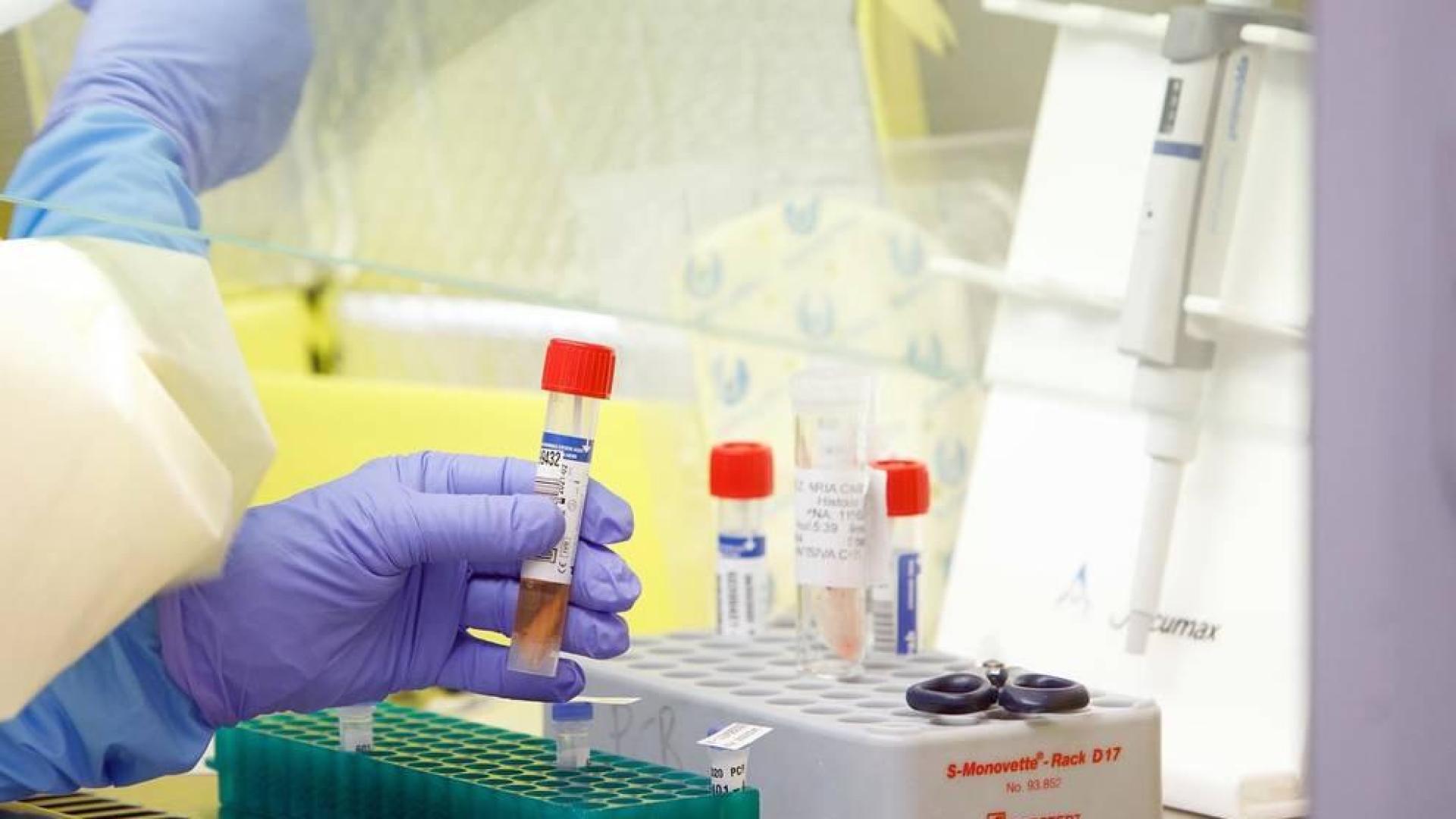 Tubo de muestra de coronavirus para analizar