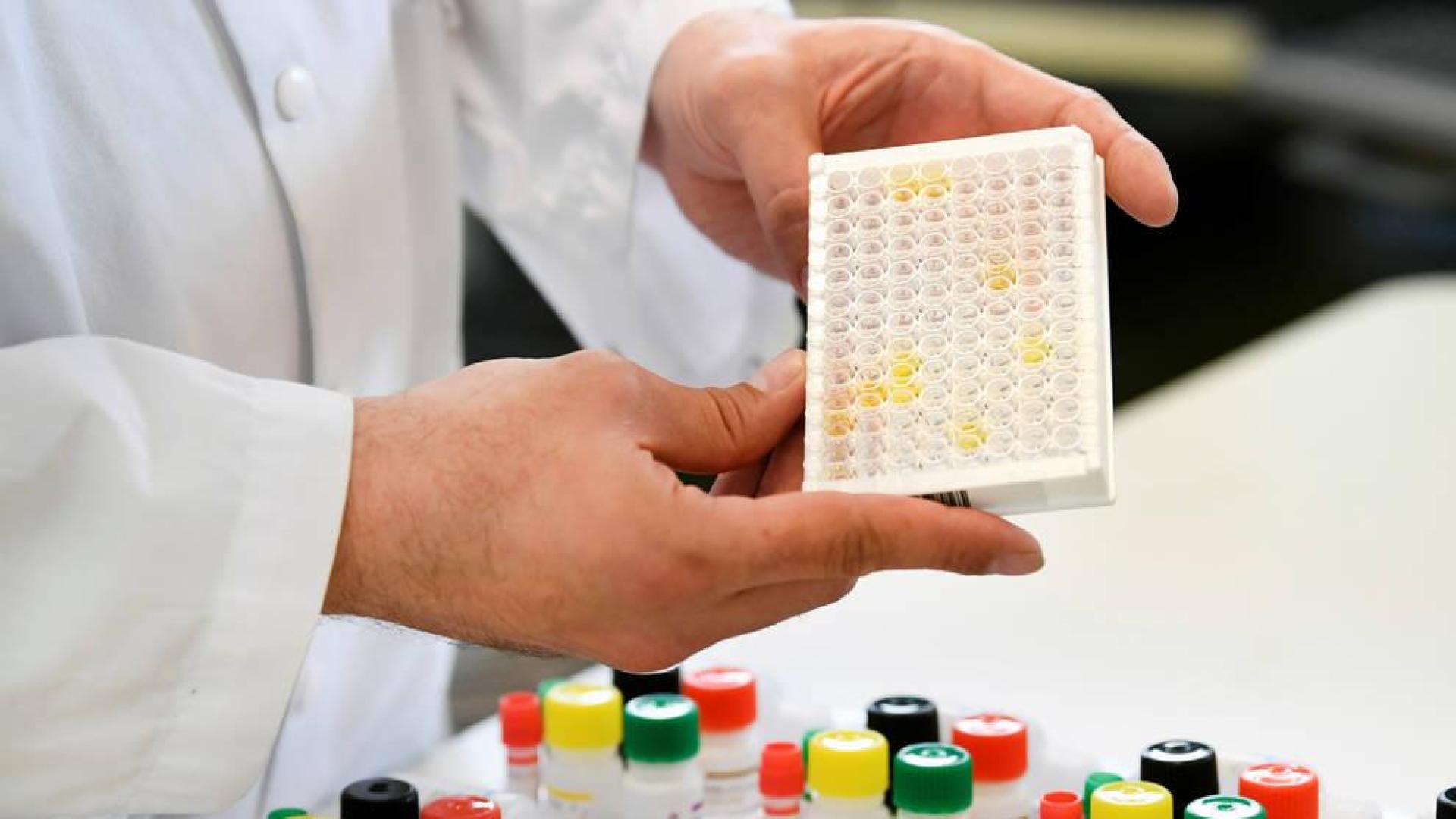 Investigación en un laboratorio de Amsterdam.