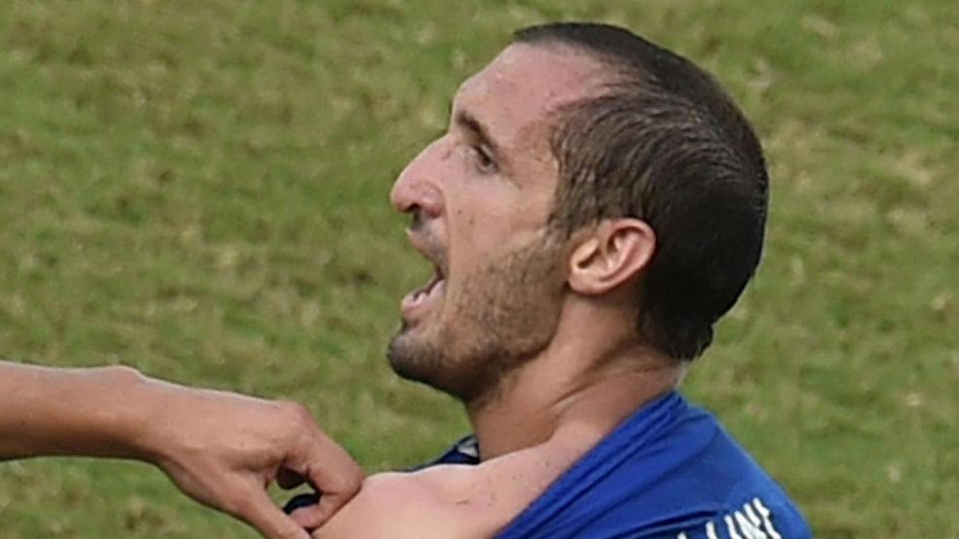 Abren expediente a Su&aacute;rez por su mordisco a Chiellini