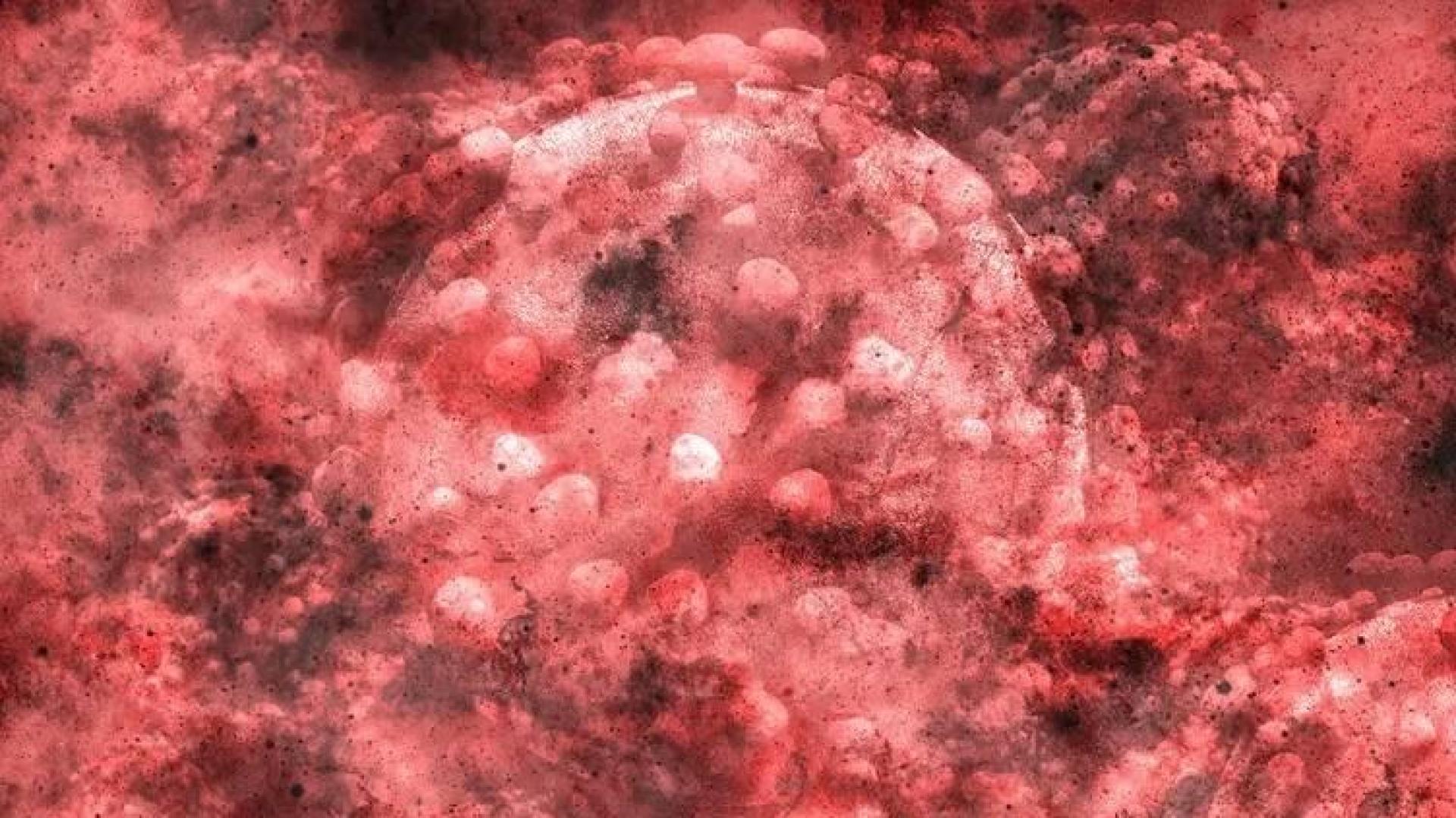 ¿Nuevas terapias para COVID-19? Sus factores de riesgo dan pistas