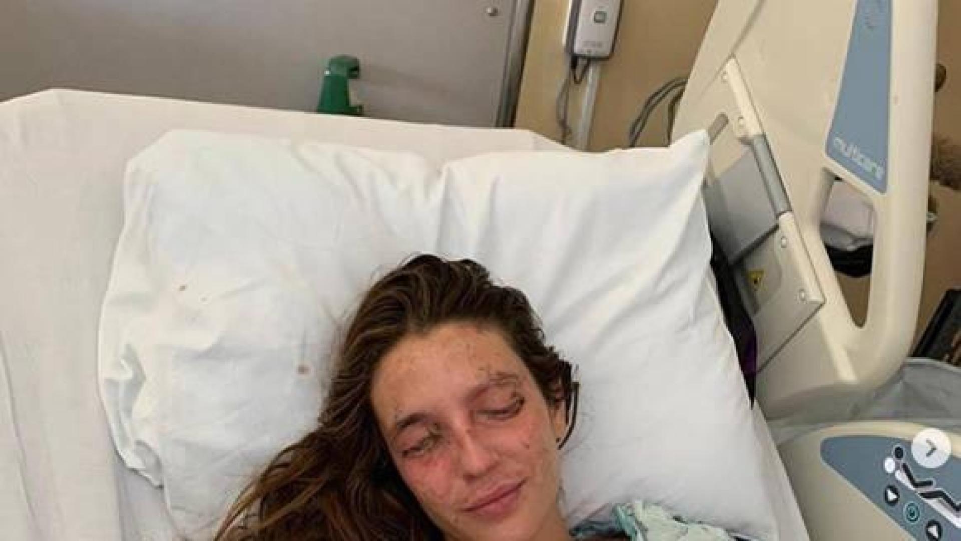 10.000 personas donan 200.000 euros en 24 horas para una joven de Terrassa