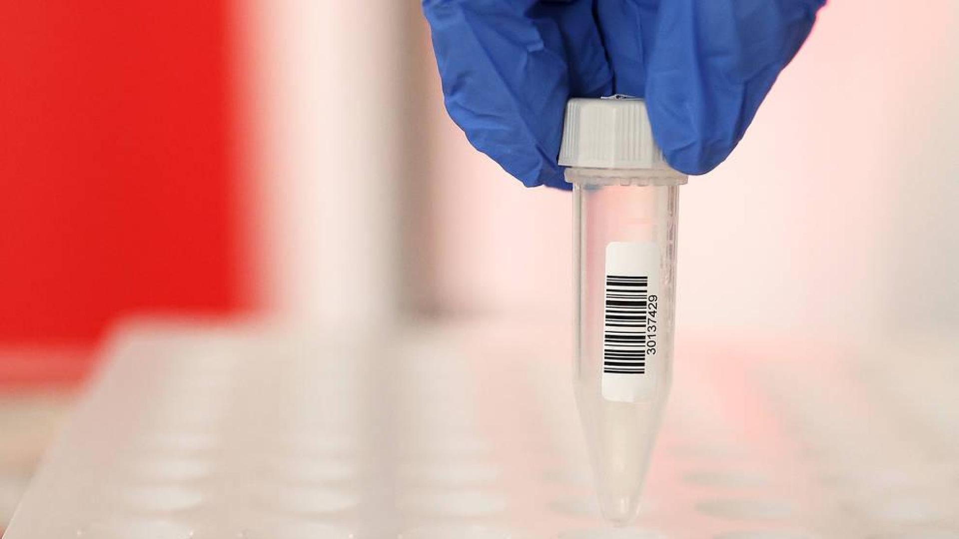 Sanidad confirma la reducción de contagios a 84 en las últimas 24 horas