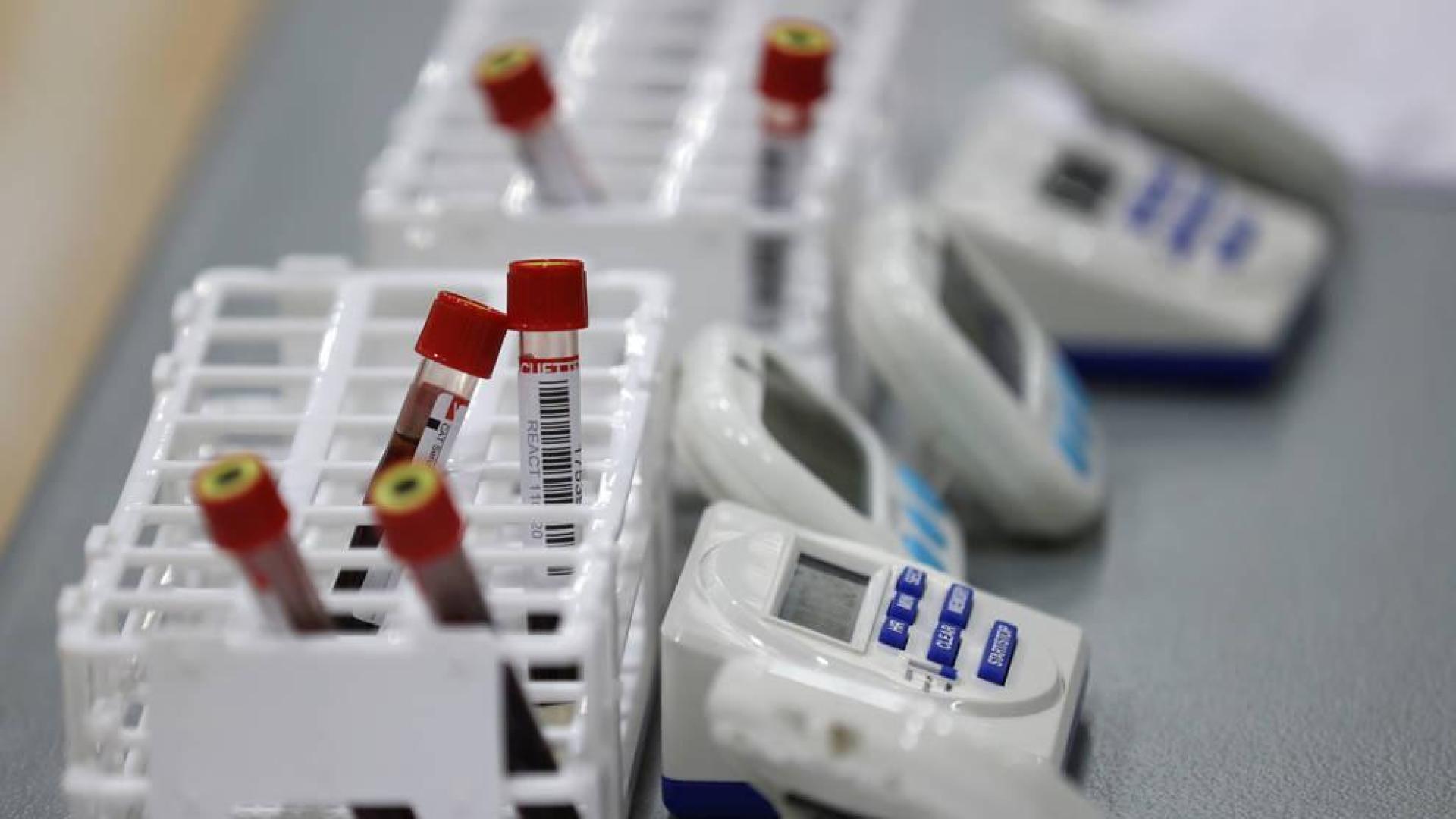 Sanidad registra otras nueve muertes y 99 contagios de covid en 24 horas