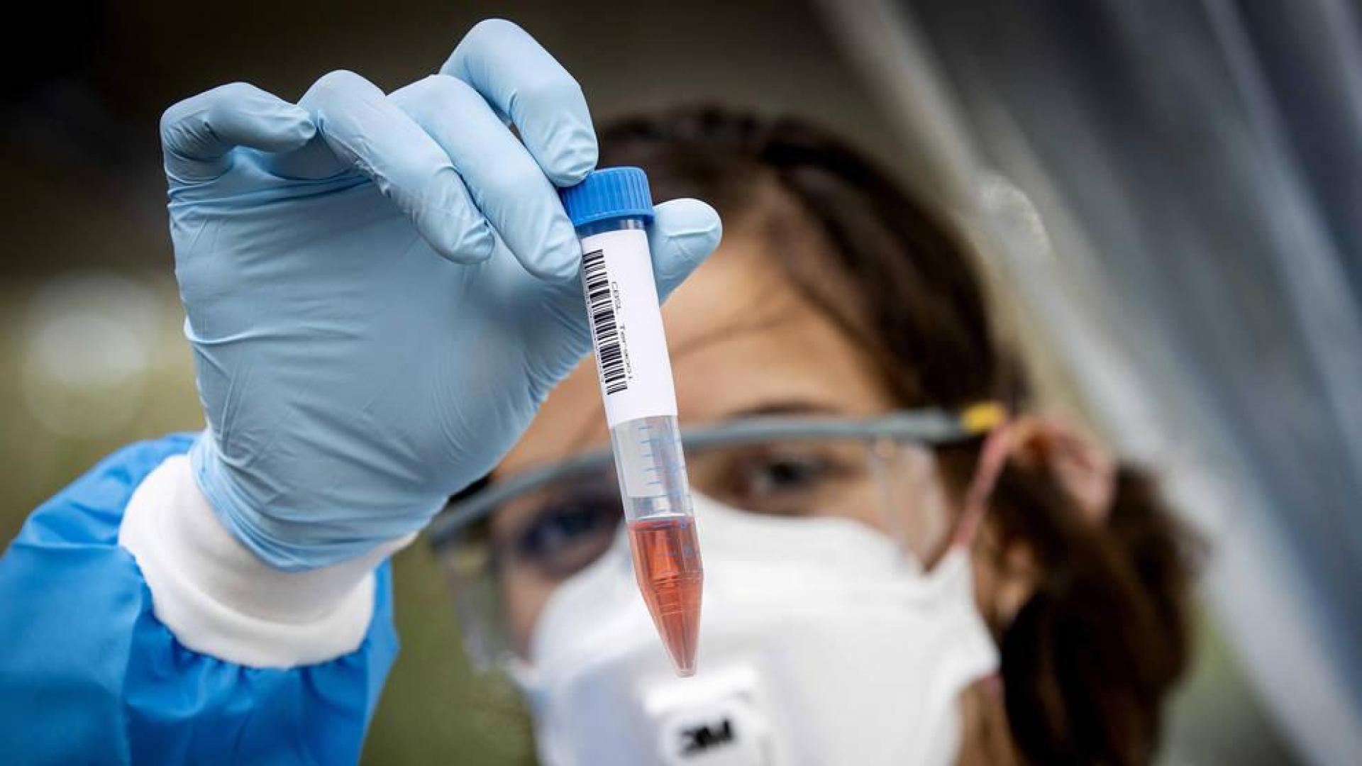 Sanidad notifica 10.653 nuevos casos, 3.471 en 24 horas, y 84 muertes