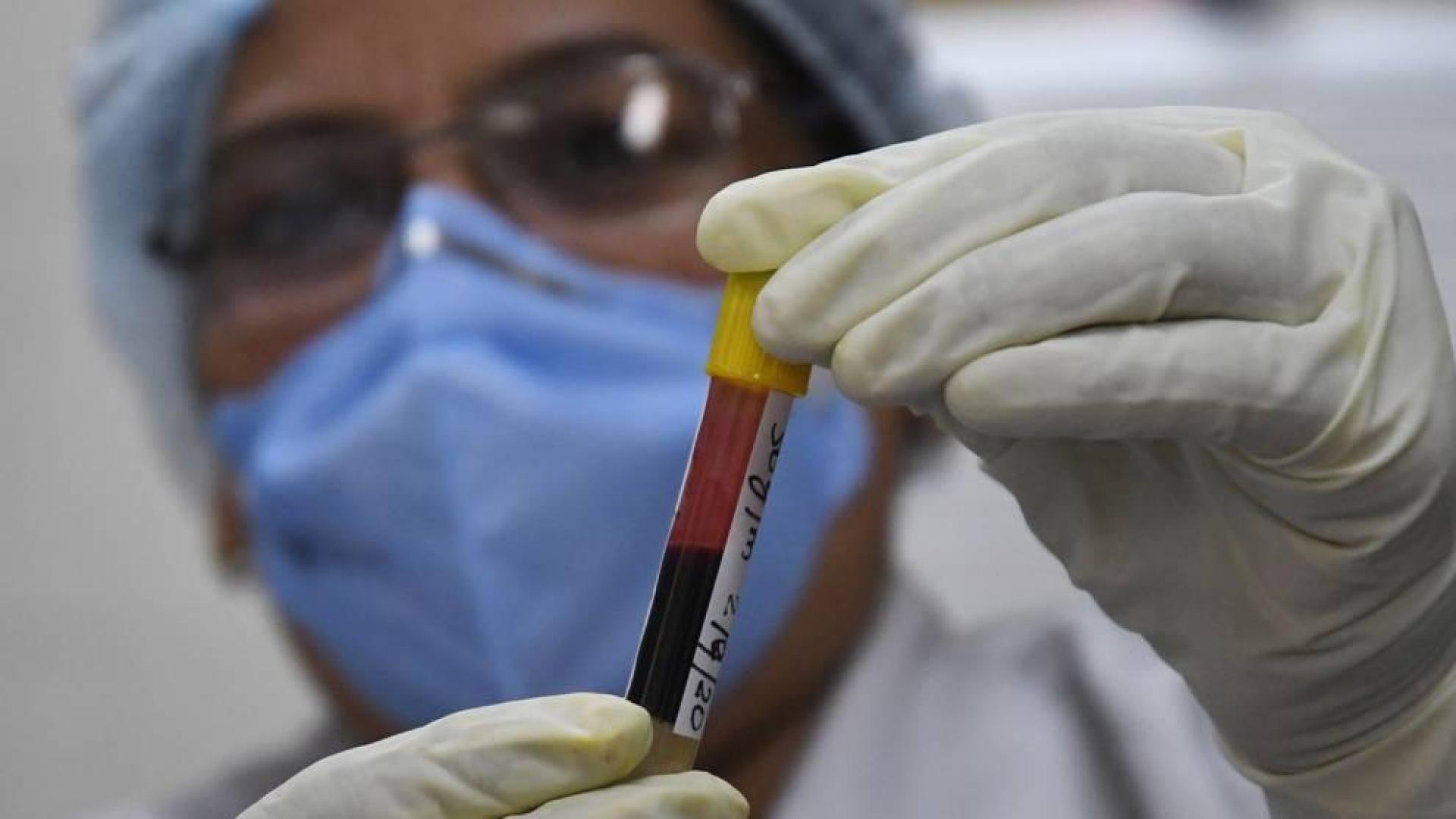 El plasma hiperinmune podría reducir los ingresos en UCI o fallecimientos por covid