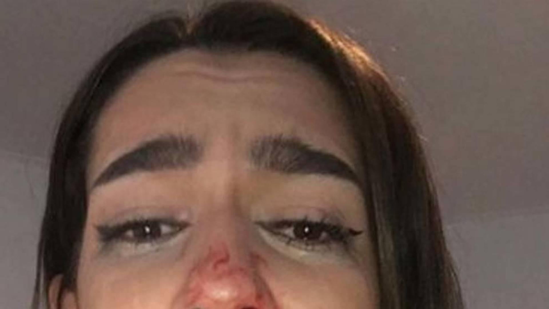 Una joven pamplonesa denuncia una agresión tránsfoba en Barcelona