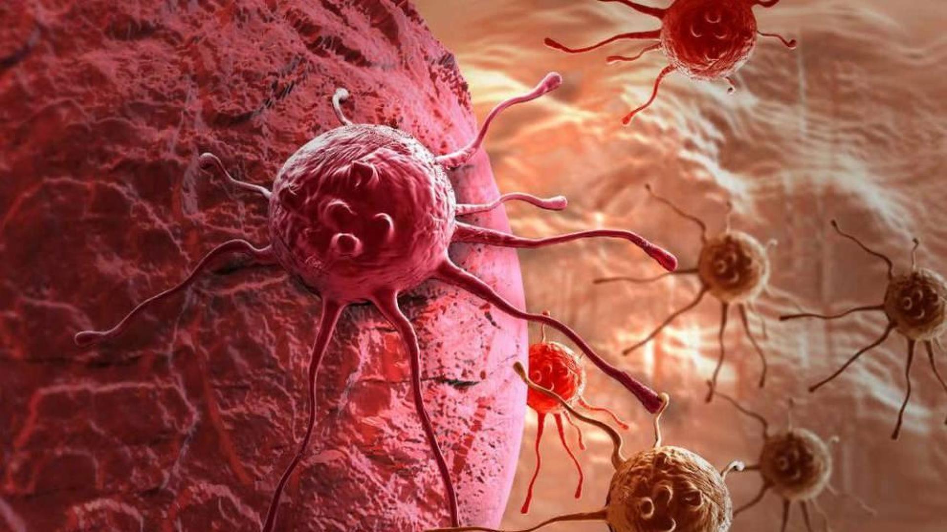 Células tumorales y de cáncer