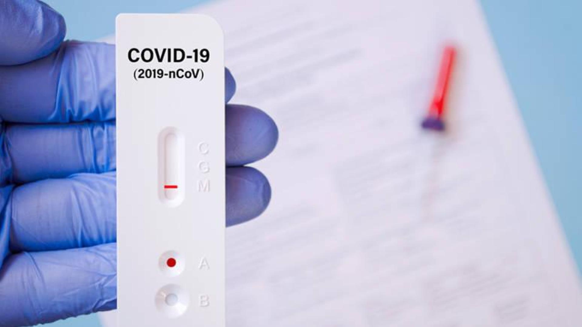 Las farmacias cuentan ya con guías informativas sobre los test rápidos de anticuerpos