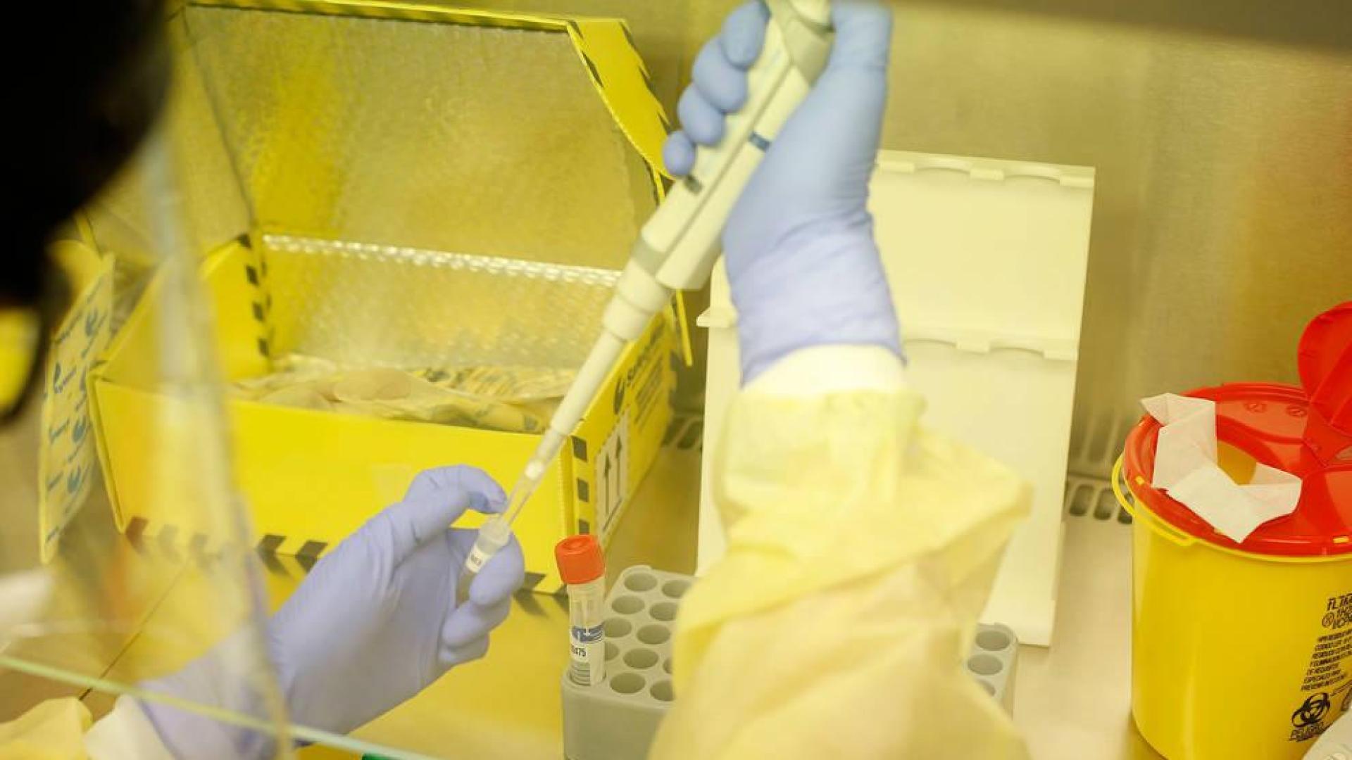 Análisis de coronavirus en el laboratorio del CHN.