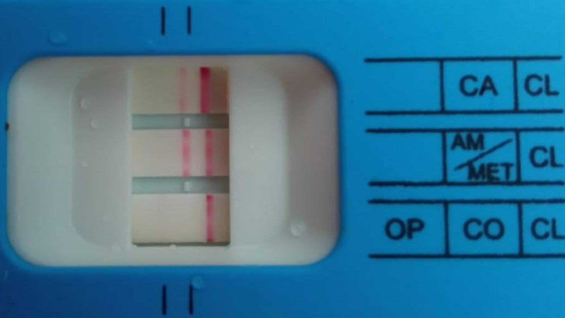 Test de drogas positivo.