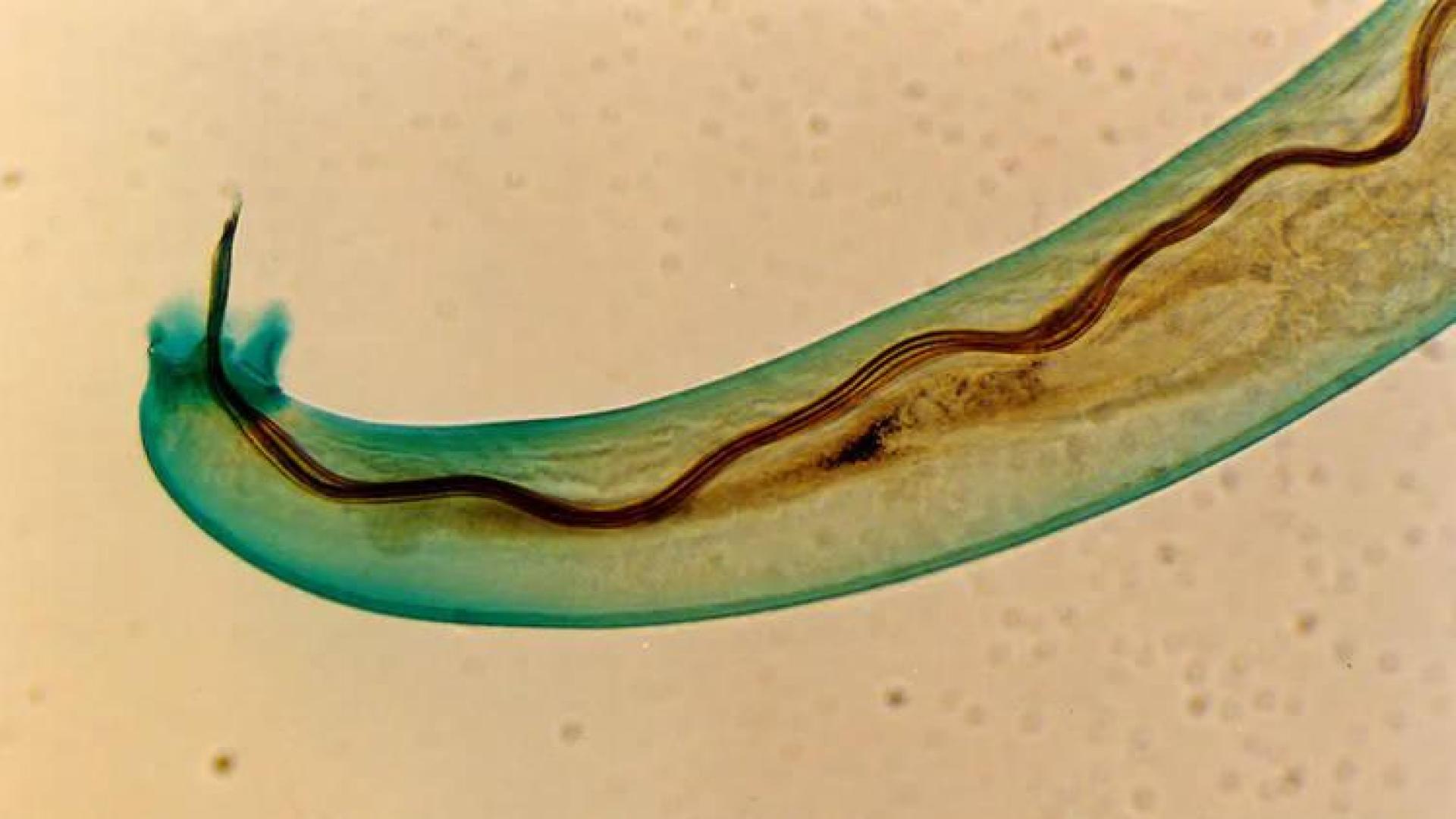 Angiostrongylus cantonensis, gusano pulmonar de las ratas.
