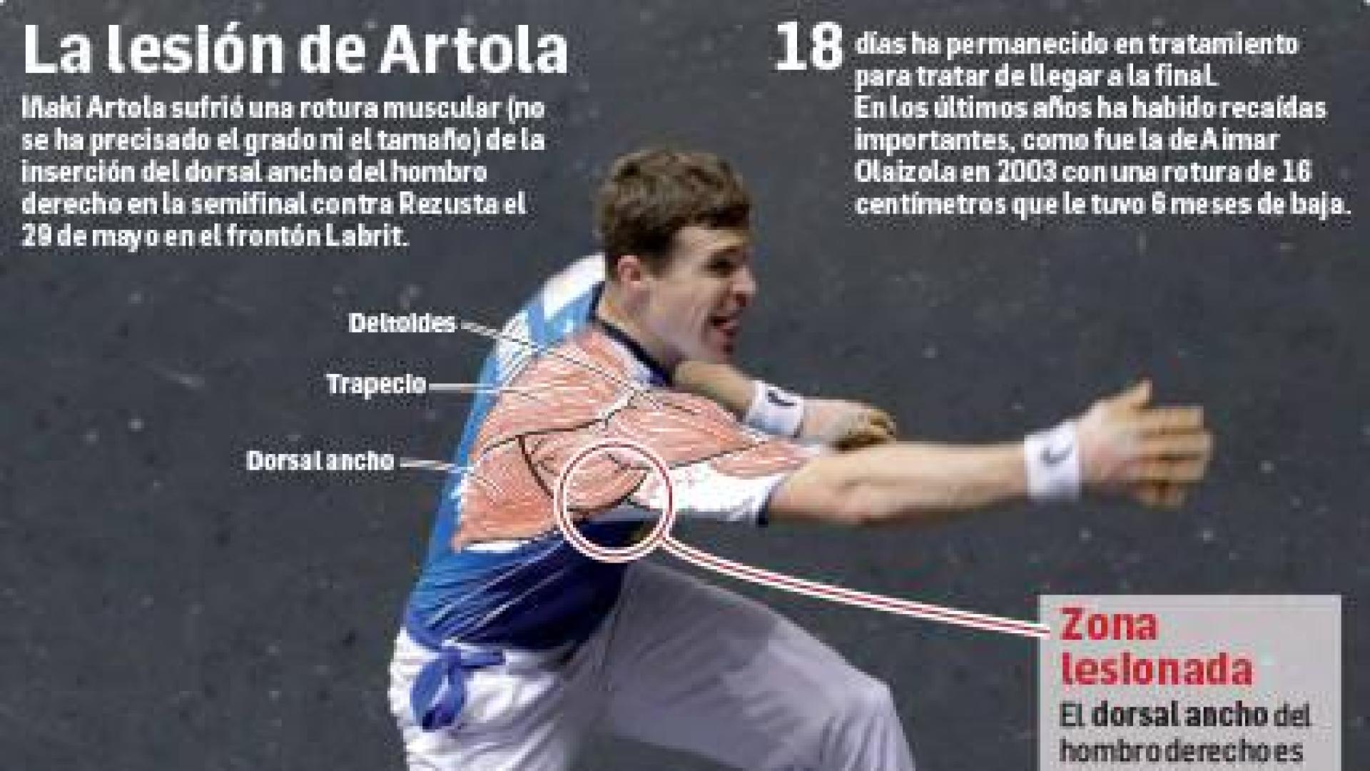 Lesión de Iñaki Artola