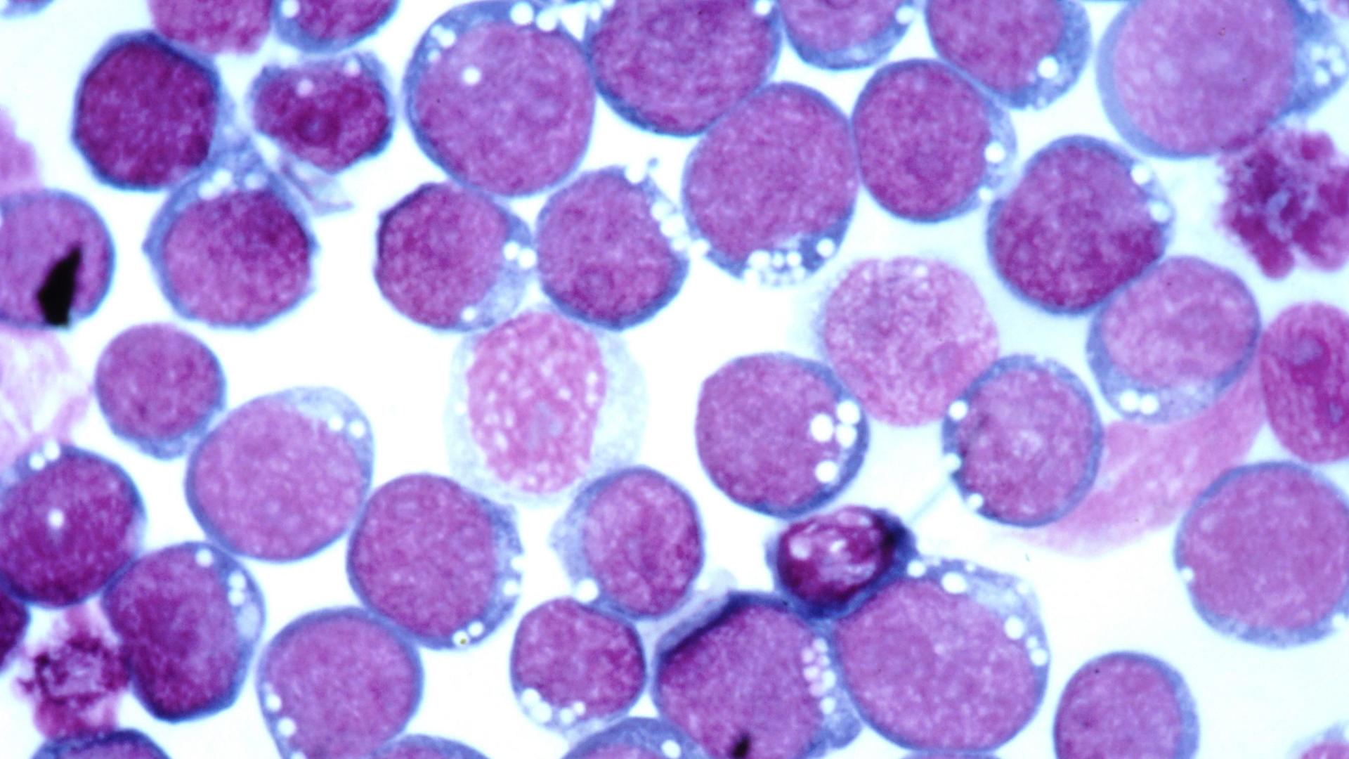Virus de Epstein-Barr