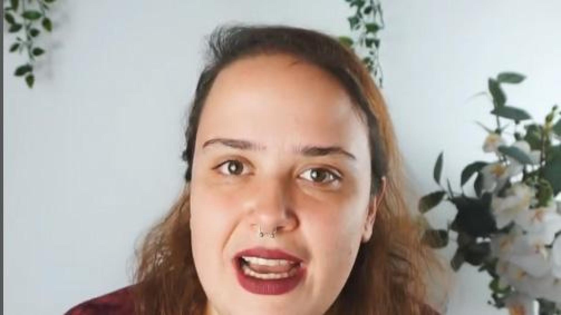 La instagramer Carlota Quiroga sufre alopecia androgenética desde los 14 años