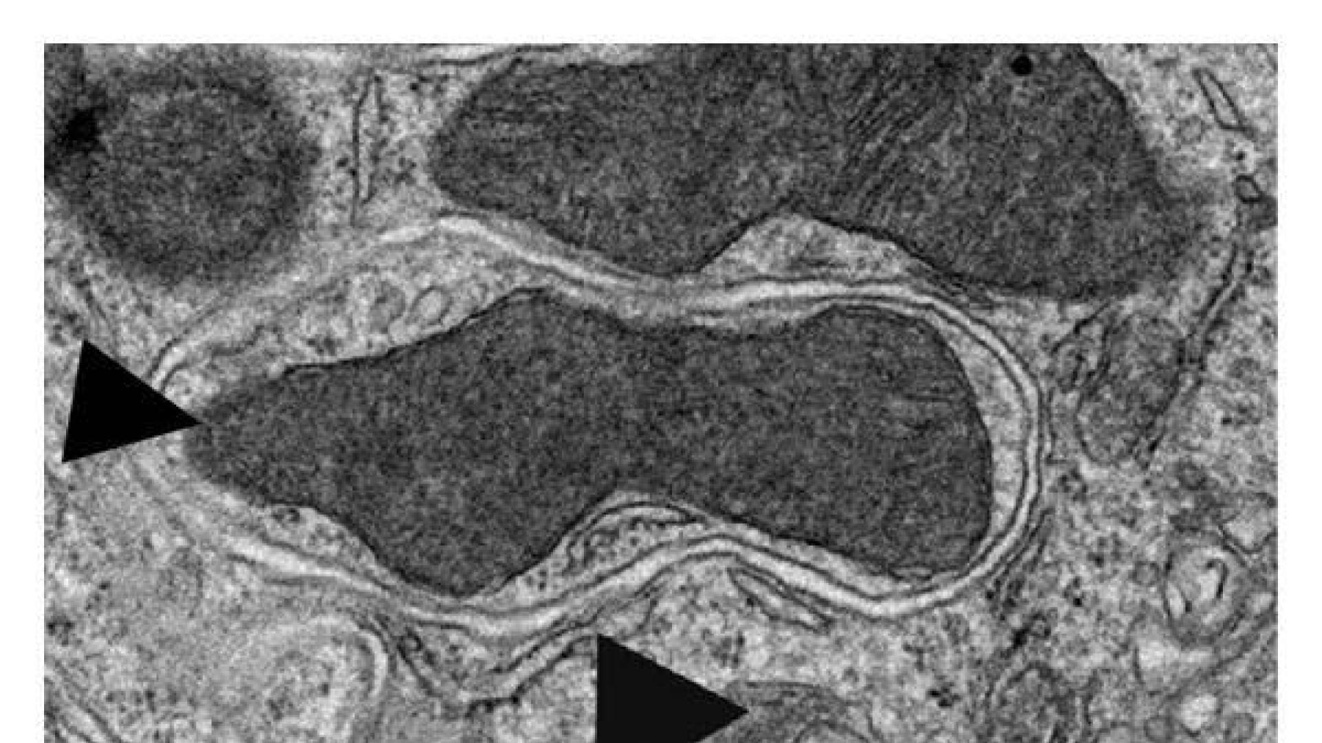 Imagen de microscopía electrónica de transmisión de una vesícula autofágica en el riñón de un ratón
