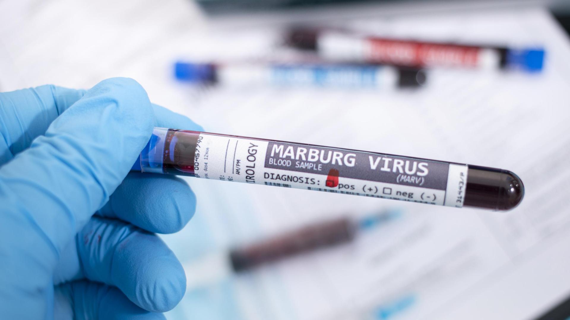 El virus de Marburgo es de la misma familia que el Ébola