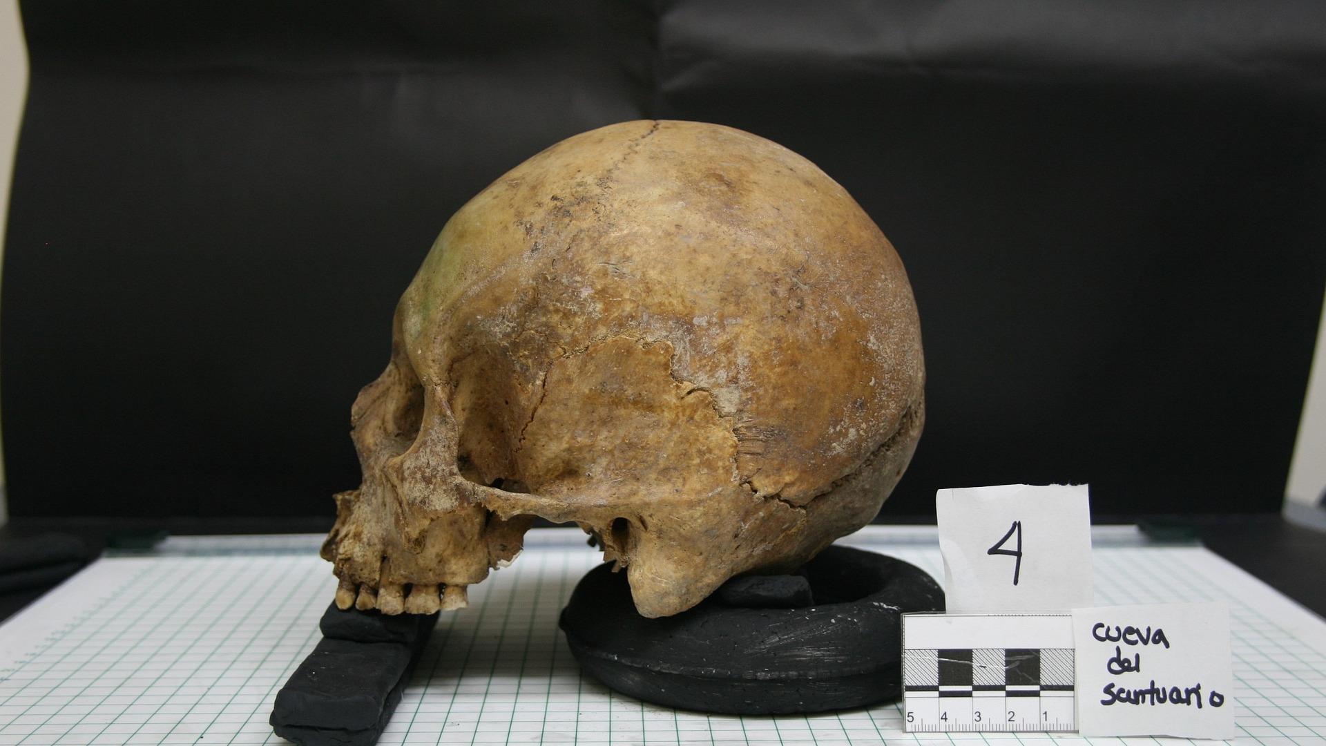 Imagen de archivo de un cráneo hallado en una investigación