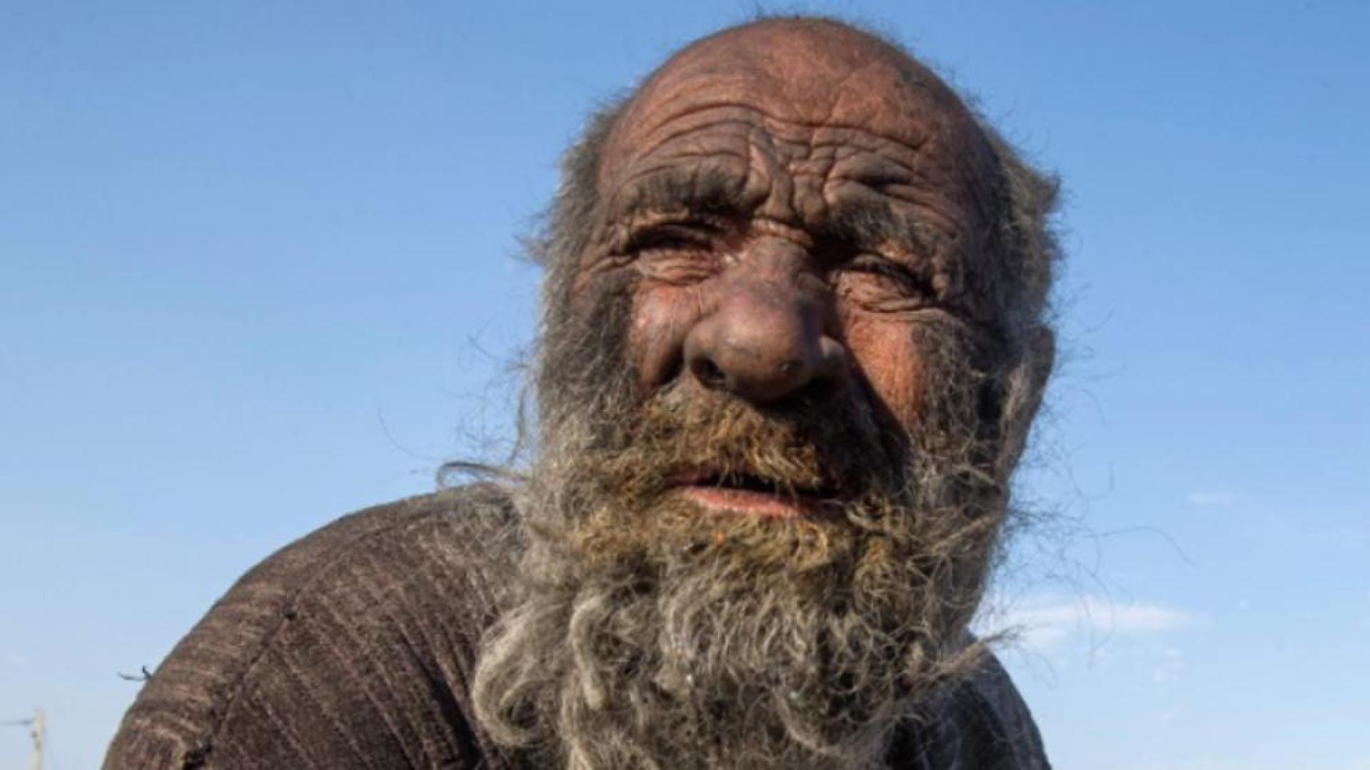 Imagen de Amou Haji, "el hombre más sucio del mundo"