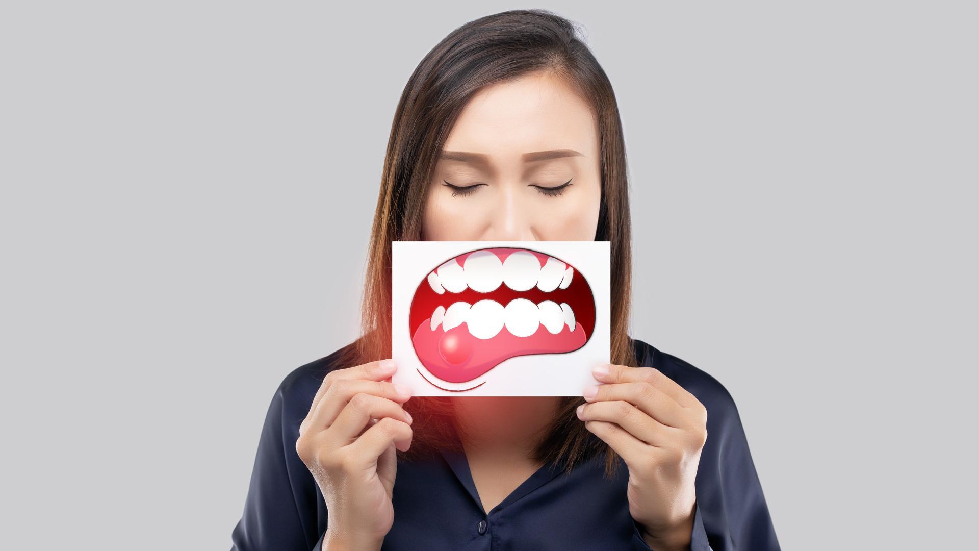Entre 8 y 9 de cada 10 personas mayores de 35 años presentan alguna enfermedad de las encías: gingivitis o periodontitis
