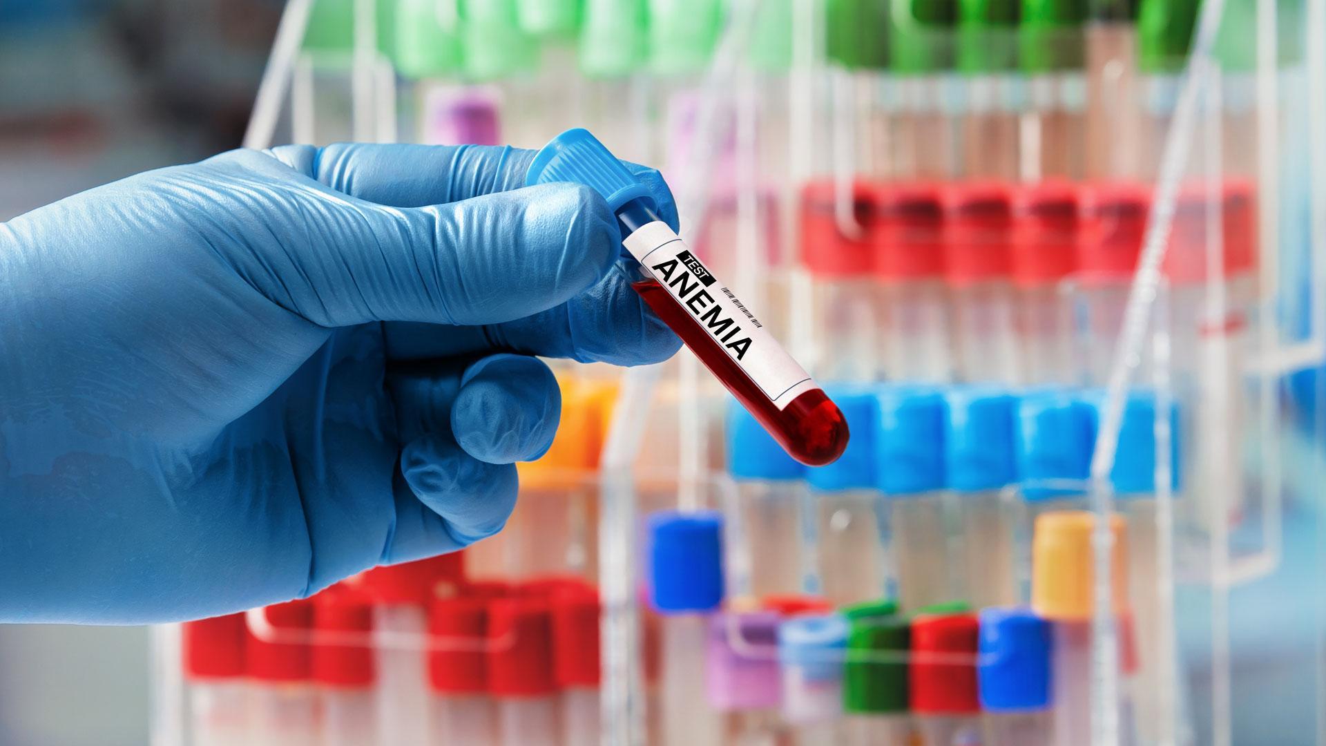 Un recipiente para la extracción de sangre