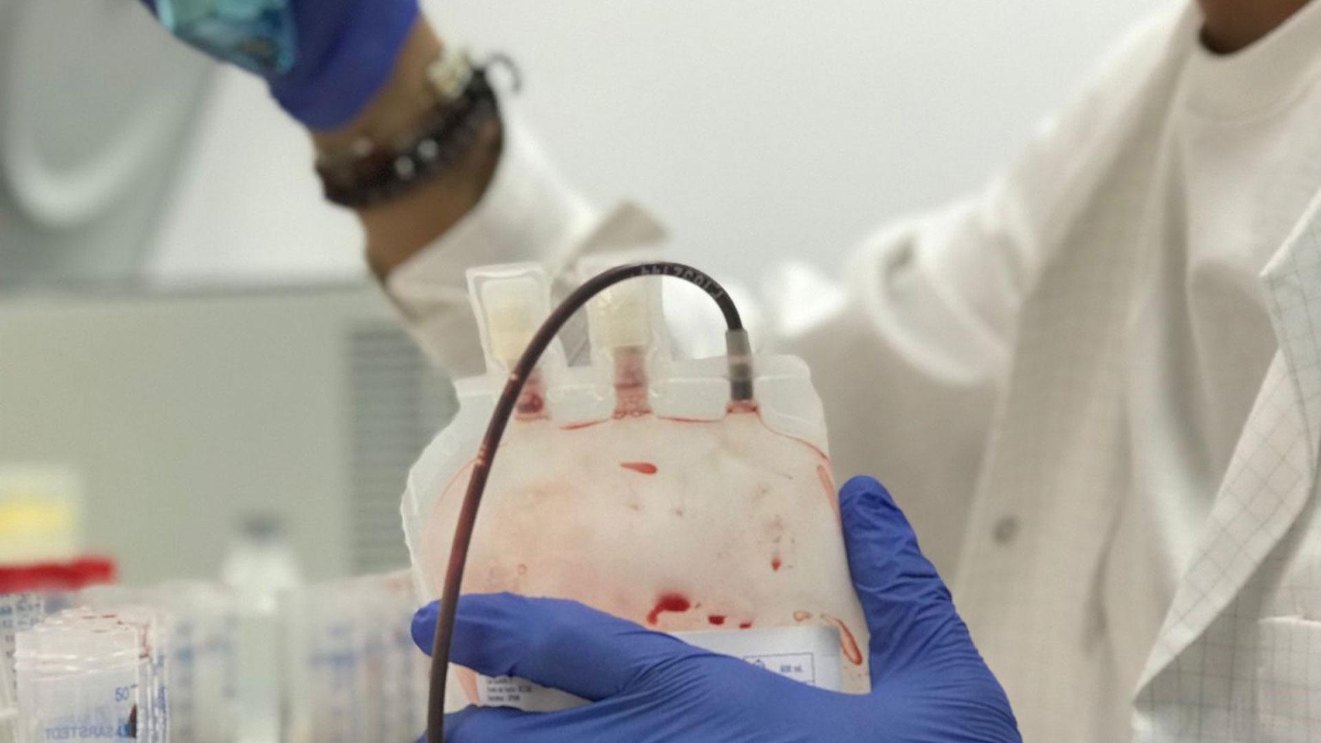 Investigadores desarrollan metodología para diagnóstico precoz de cáncer de mama con una sola muestra de sangre