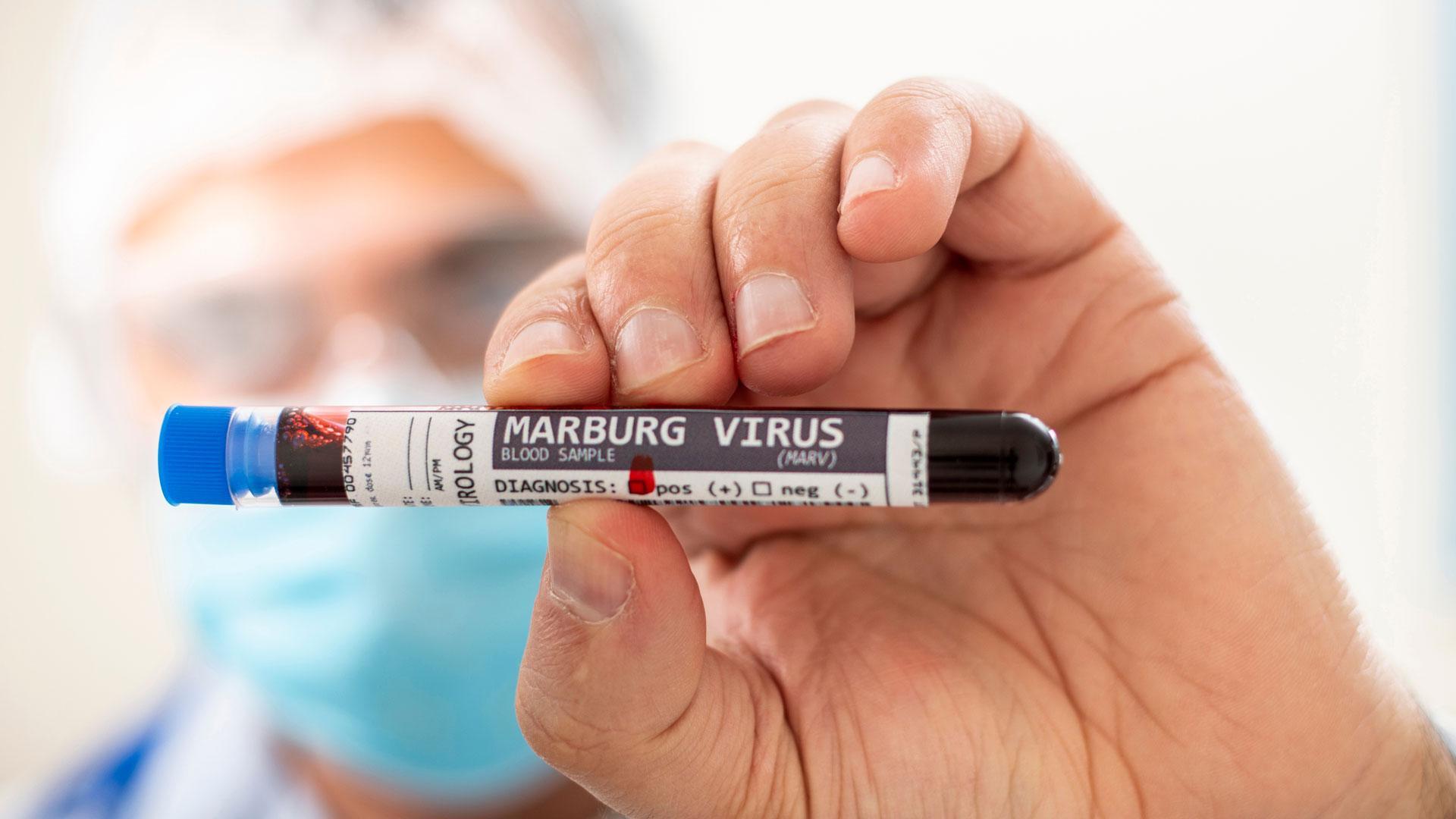 El virus de Marburgo es un virus de ARN altamente patógeno que pertenece al orden Mononegavirales y, al igual que el virus del ébol