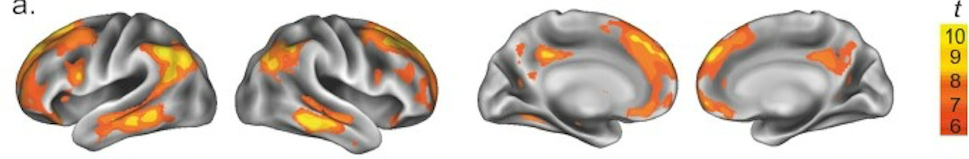 Mapas de superficie de los cambios en el volumen de la sustancia gris durante el embarazo. En él se aprecian la multitud de regiones que se afectan, incluyendo la corteza cerebral