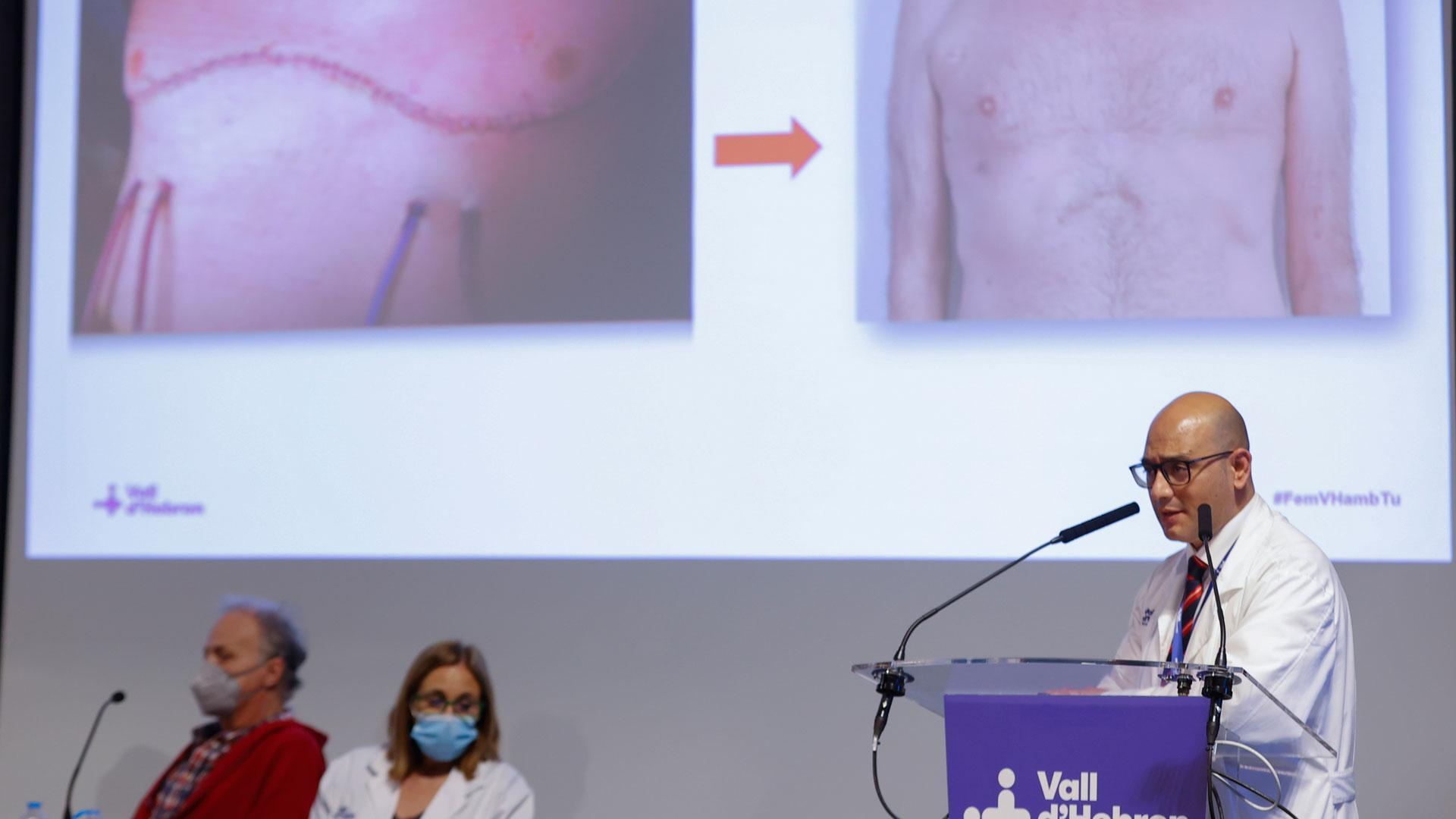 El jefe de Servicio de Cirugía Torácica y Trasplante Pulmonar de Vall d'Hebron, Albert Jauregui, durante la rueda de prensa en la que se ha anunciado que se ha llevado a cabo con éxito el primer trasplante pulmonar con cirugía completamente robótica